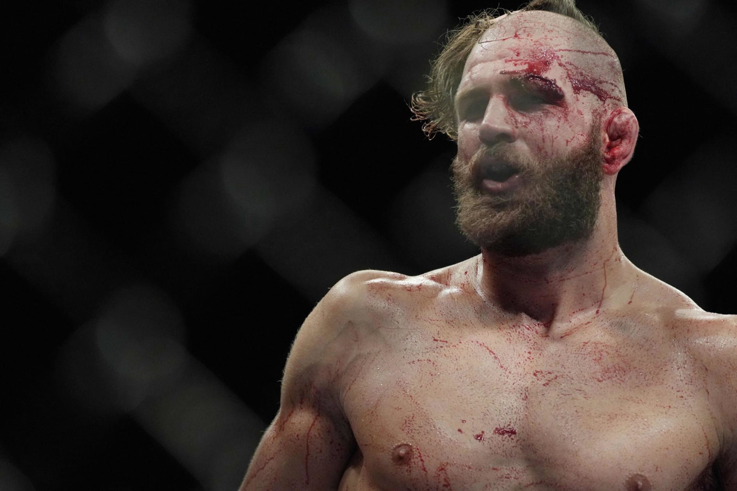 Czech Republic's Jiri Prochazka looks on while competing against Brazil's Glover Teixeira in their men's light heavyweight title match during the Ultimate Fighting Championship (UFC) 275 event in Singapore on June 12, 2022. (Photo by NICHOLAS YEO / AFP) (Photo by NICHOLAS YEO/AFP via Getty Images) Czech Republic's Jiri Prochazka looks on while competing against Brazil's Glover Teixeira in their men's light heavyweight title match during the Ultimate Fighting Championship (UFC) 275 event in Singapore on June 12, 2022. (Photo by NICHOLAS YEO / AFP) (Photo by NICHOLAS YEO/AFP via Getty Images)