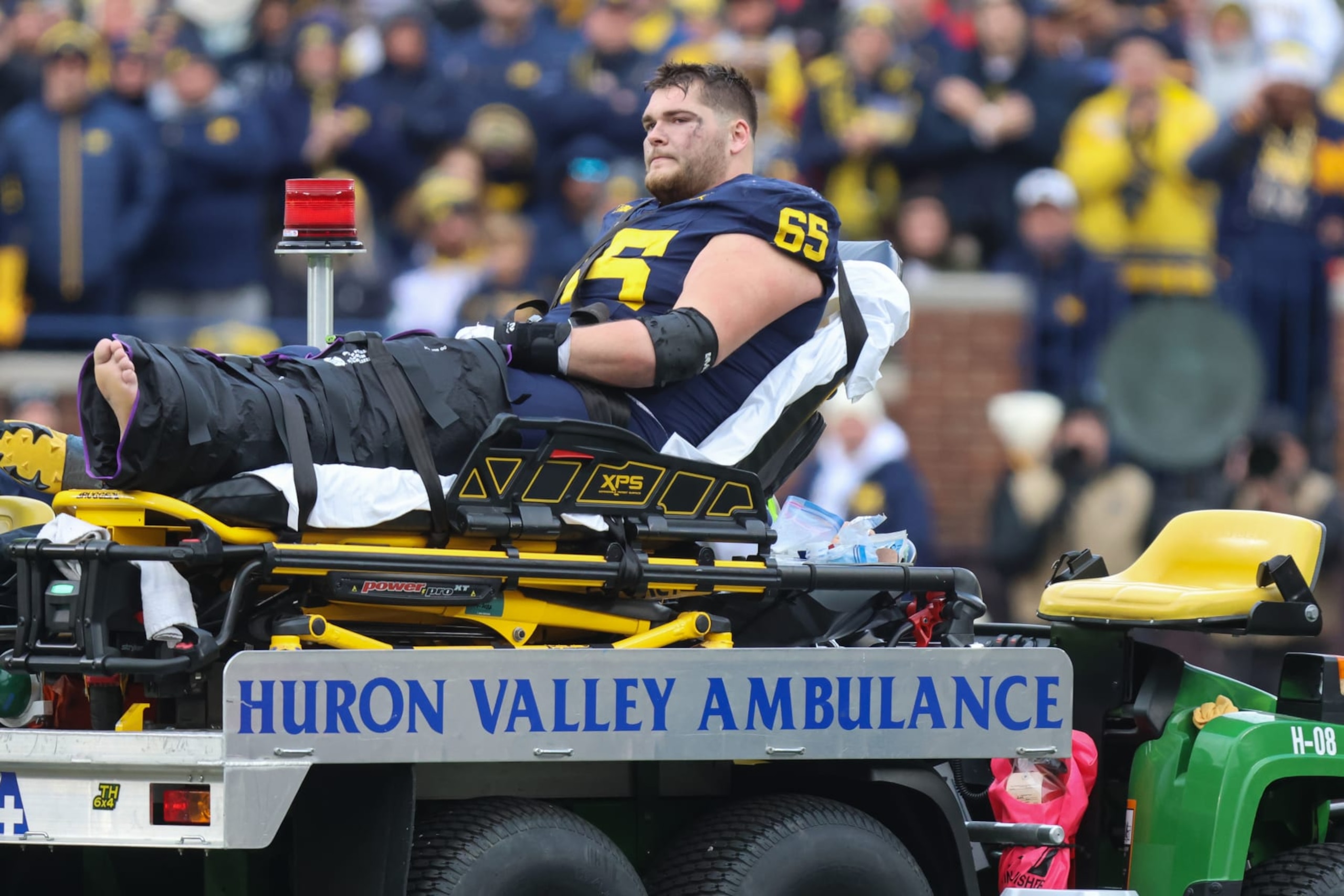ANN ARBOR, MI - NOVEMBER 25: Michigan Wolverines offensive lineman Zak Zinter (65), who sustained a lower leg injuring, looks while laying on an stretcher that is loaded onto a mobile medical cart during a regular season Big Ten Conference college football game between the Ohio State Buckeyes and the Michigan Wolverines on November 25, 2023 at Michigan Stadium in Ann Arbor, Michigan. (Photo by Scott W. Grau/Icon Sportswire via Getty Images) ANN ARBOR, MI - NOVEMBER 25: Michigan Wolverines offensive lineman Zak Zinter (65), who sustained a lower leg injuring, looks while laying on an stretcher that is loaded onto a mobile medical cart during a regular season Big Ten Conference college football game between the Ohio State Buckeyes and the Michigan Wolverines on November 25, 2023 at Michigan Stadium in Ann Arbor, Michigan. (Photo by Scott W. Grau/Icon Sportswire via Getty Images)