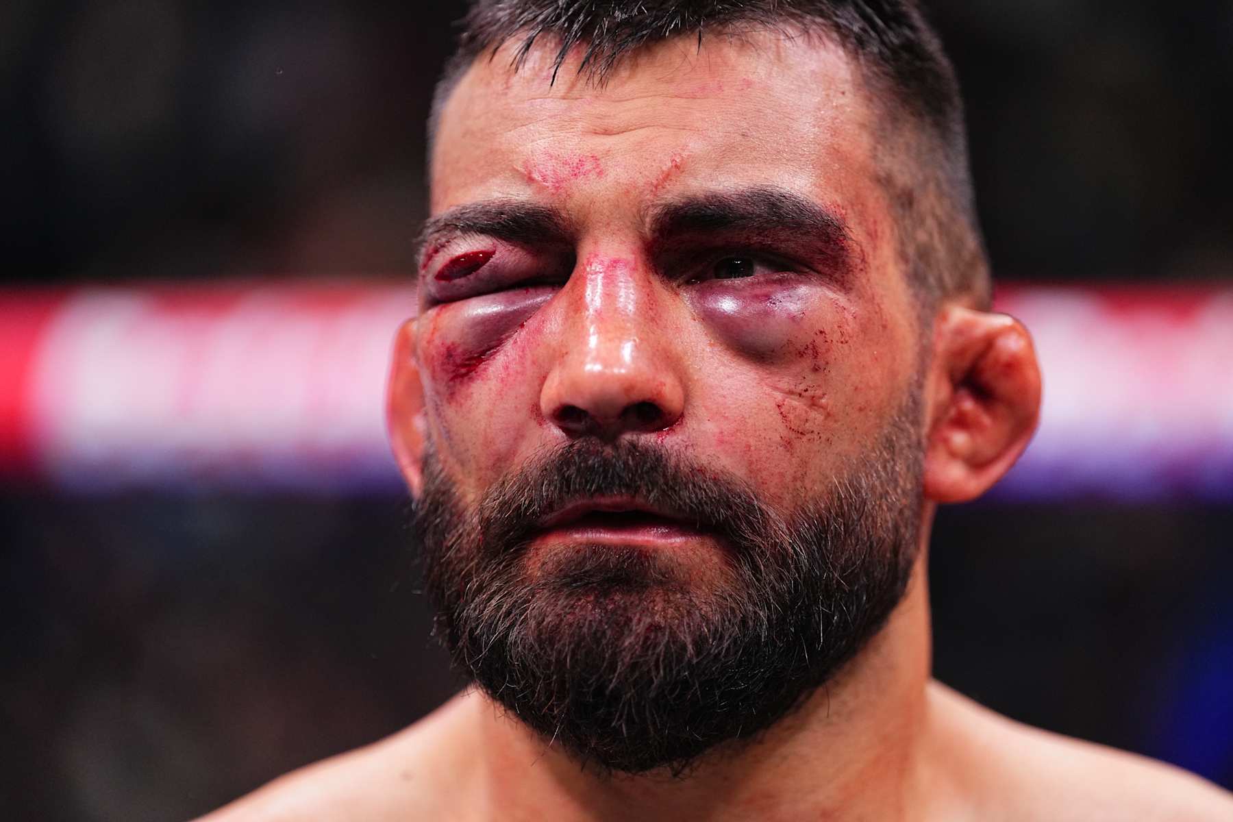 PARIS, FRANCE - SEPTEMBER 28: Benoit Saint Denis of France reacts after a TKO loss against Renato Moicano of Brazil in a lightweight fight during the UFC Fight Night event at The Accor Arena on September 28, 2024 in Paris, France.  (Photo by Chris Unger/Zuffa LLC)