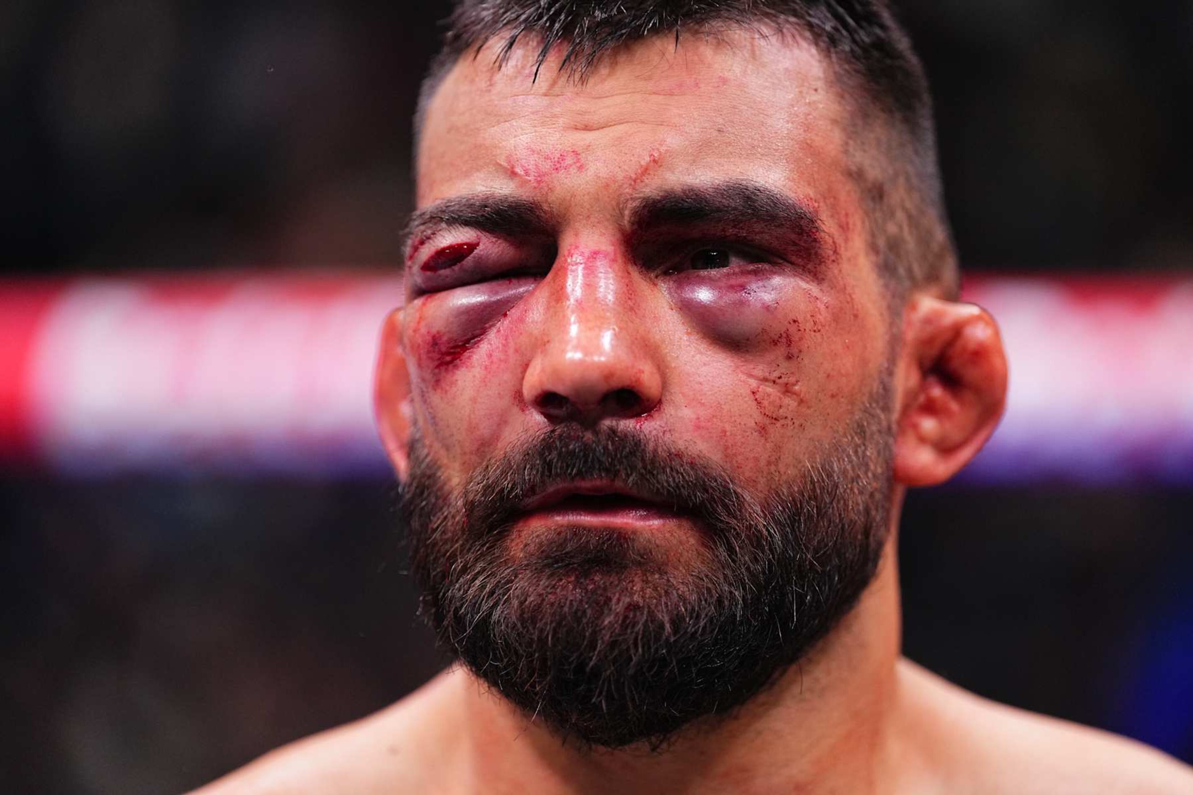 PARIS, FRANCE - SEPTEMBER 28: Benoit Saint Denis of France reacts after a TKO loss against Renato Moicano of Brazil in a lightweight fight during the UFC Fight Night event at The Accor Arena on September 28, 2024 in Paris, France. (Photo by Chris Unger/Zuffa LLC) PARIS, FRANCE - SEPTEMBER 28: Benoit Saint Denis of France reacts after a TKO loss against Renato Moicano of Brazil in a lightweight fight during the UFC Fight Night event at The Accor Arena on September 28, 2024 in Paris, France. (Photo by Chris Unger/Zuffa LLC)