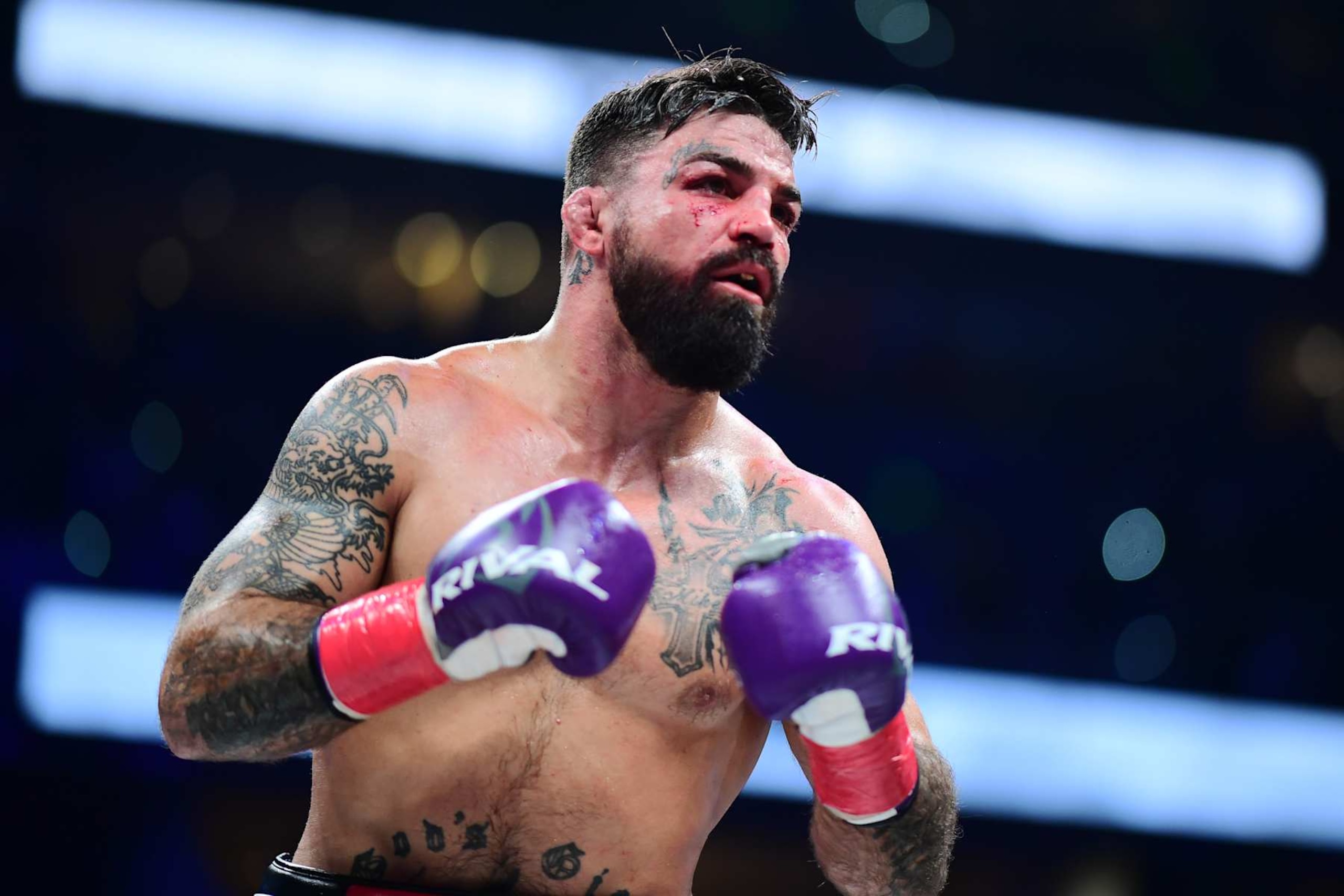 Mike Perry looks on during a fight with Jake Paul