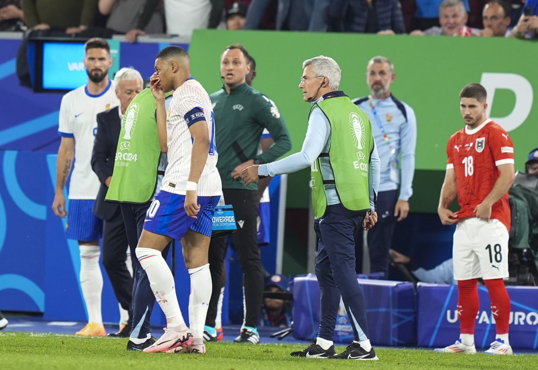 DUSSELDORF, GERMANY - JUNE 17: Kylian Mbappe (10) of France bleed from the nose during the 2024 European Football Championship (EURO 2024) Group D football match between France and Austria at Merkur Spiel-Arena in Dusseldorf, Germany on June 17, 2024. (Photo by Emin Sansar/Anadolu via Getty Images)
