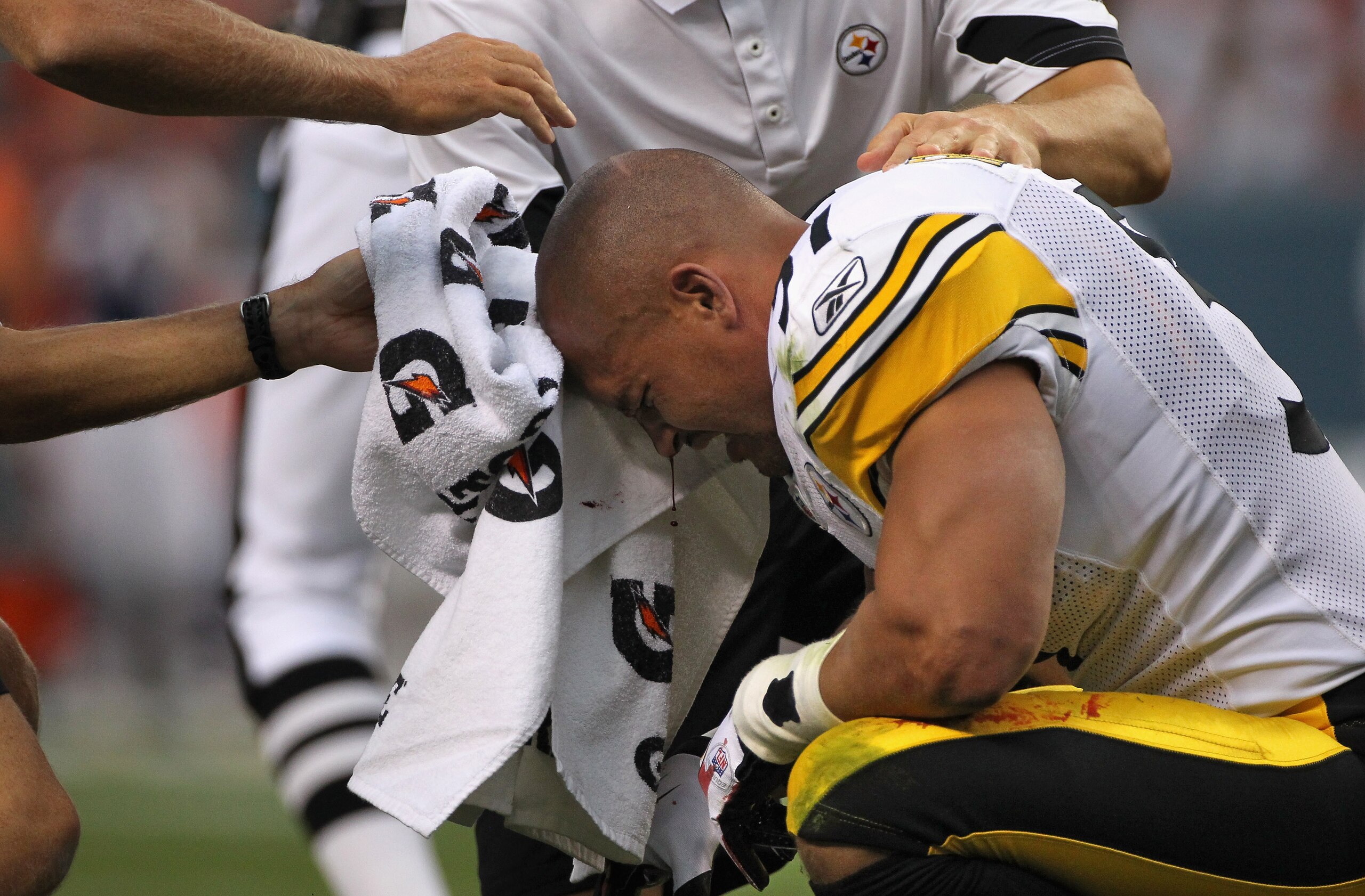 DENVER - AUGUST 29:  Linebacker James Farrior #51 of the Pittsburgh Steelers is attended to after loosing his helmet and bleeding from an injury on the play in the first quarter against the Denver Broncos during preseason NFL action at INVESCO Field at Mi