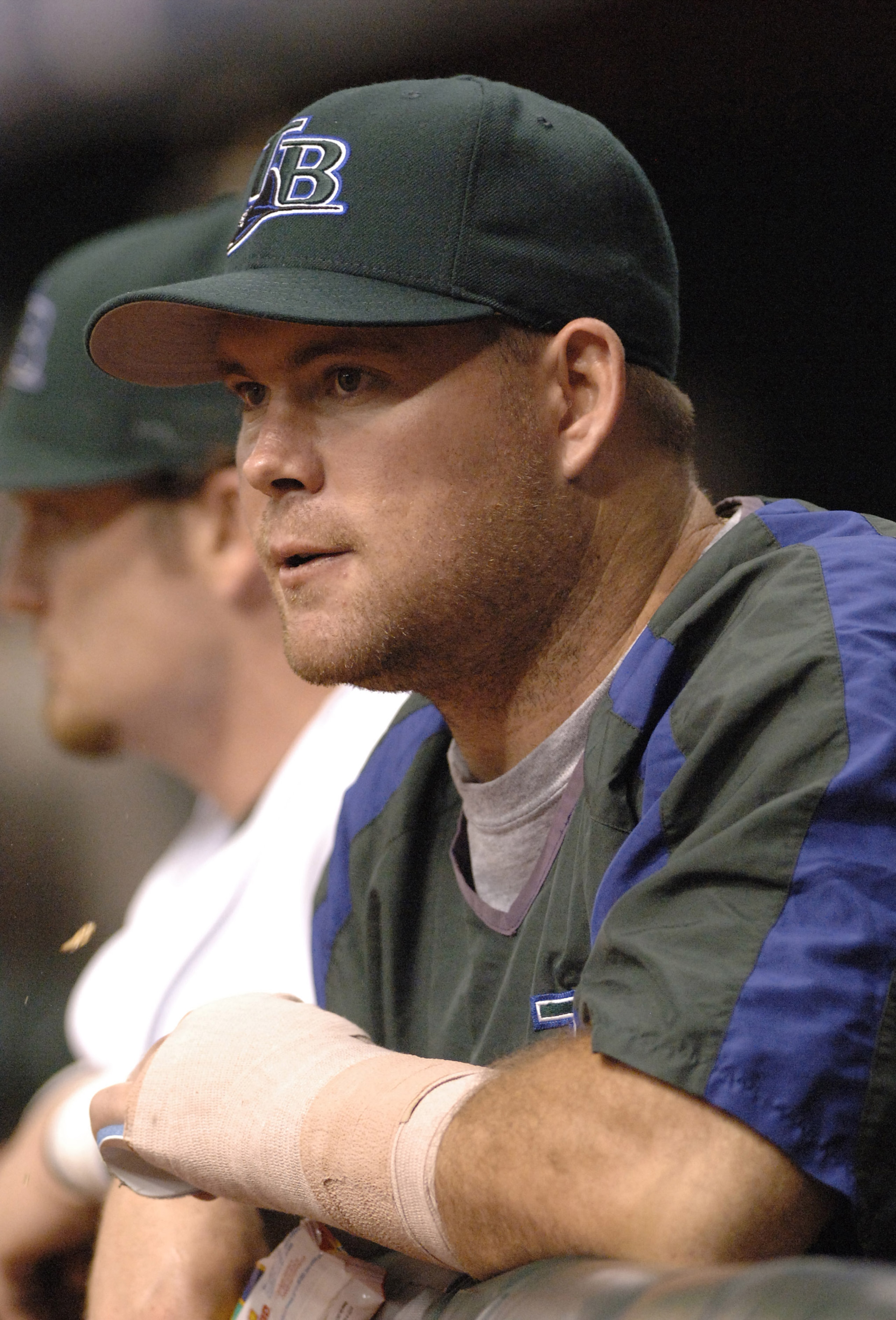 Tampa Bay Devil Rays Ty Wigginton spors a cast on an injured left arm August 1, 2006 in St. Petersburg.  The Detroit Tigers won 10 - 4, the team's 71st win of the season.  Wigginton is on the disabled list. (Photo by A. Messerschmidt/Getty Images) *** Loc