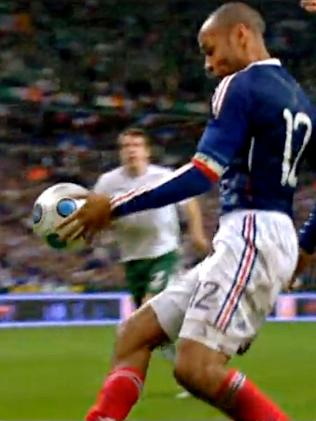 Thierry! This is not volleyball! NO!