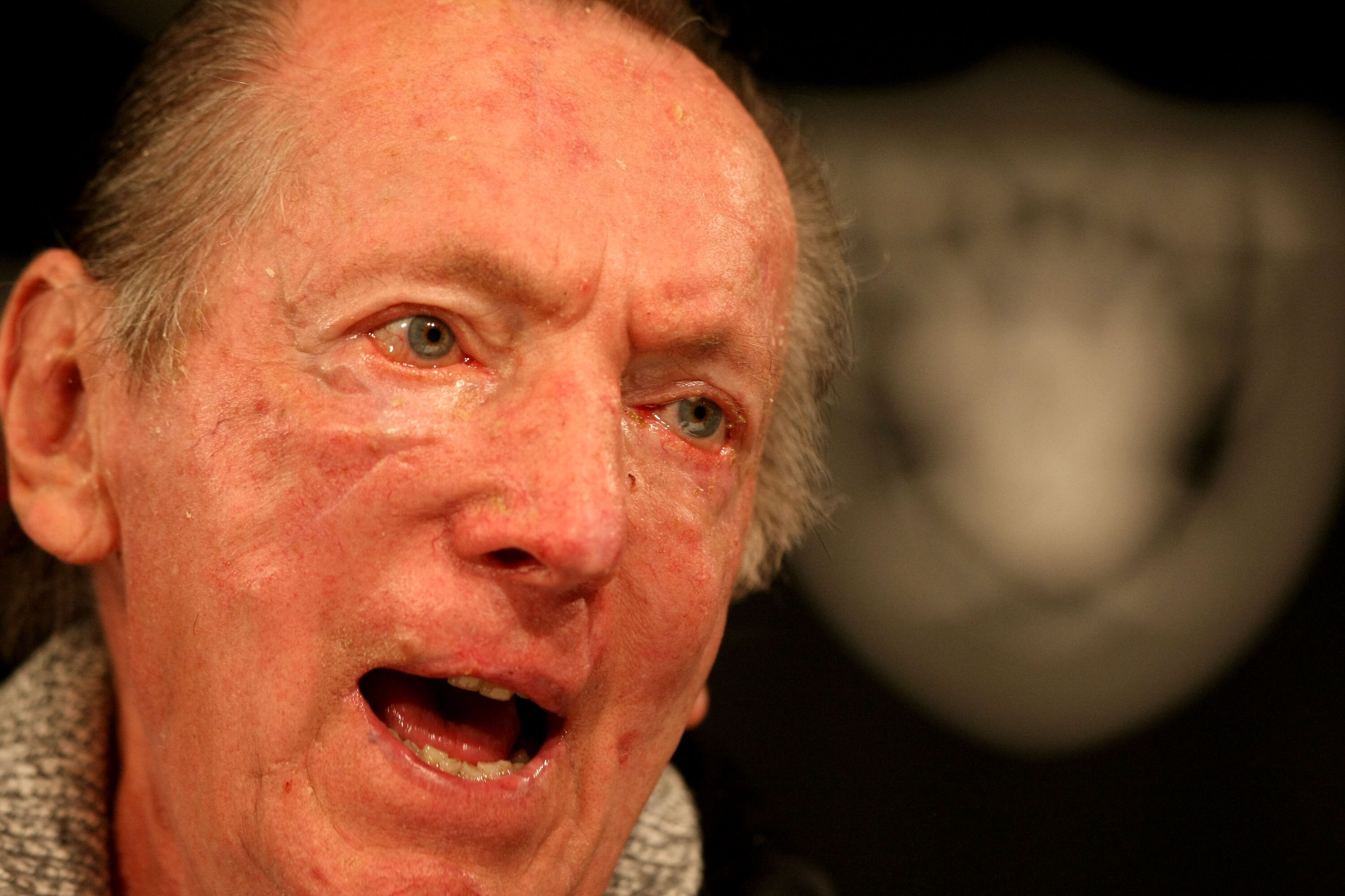 ALAMEDA, CA - SEPTEMBER 30:  Oakland Raiders owner Al Davis speaks during a press conference to announce the firing of head coach Lane Kiffin of the Oakland Raiders at thier training facility on Septemer 30, 2008 in Alameda, California.  (Photo by Jed Jac