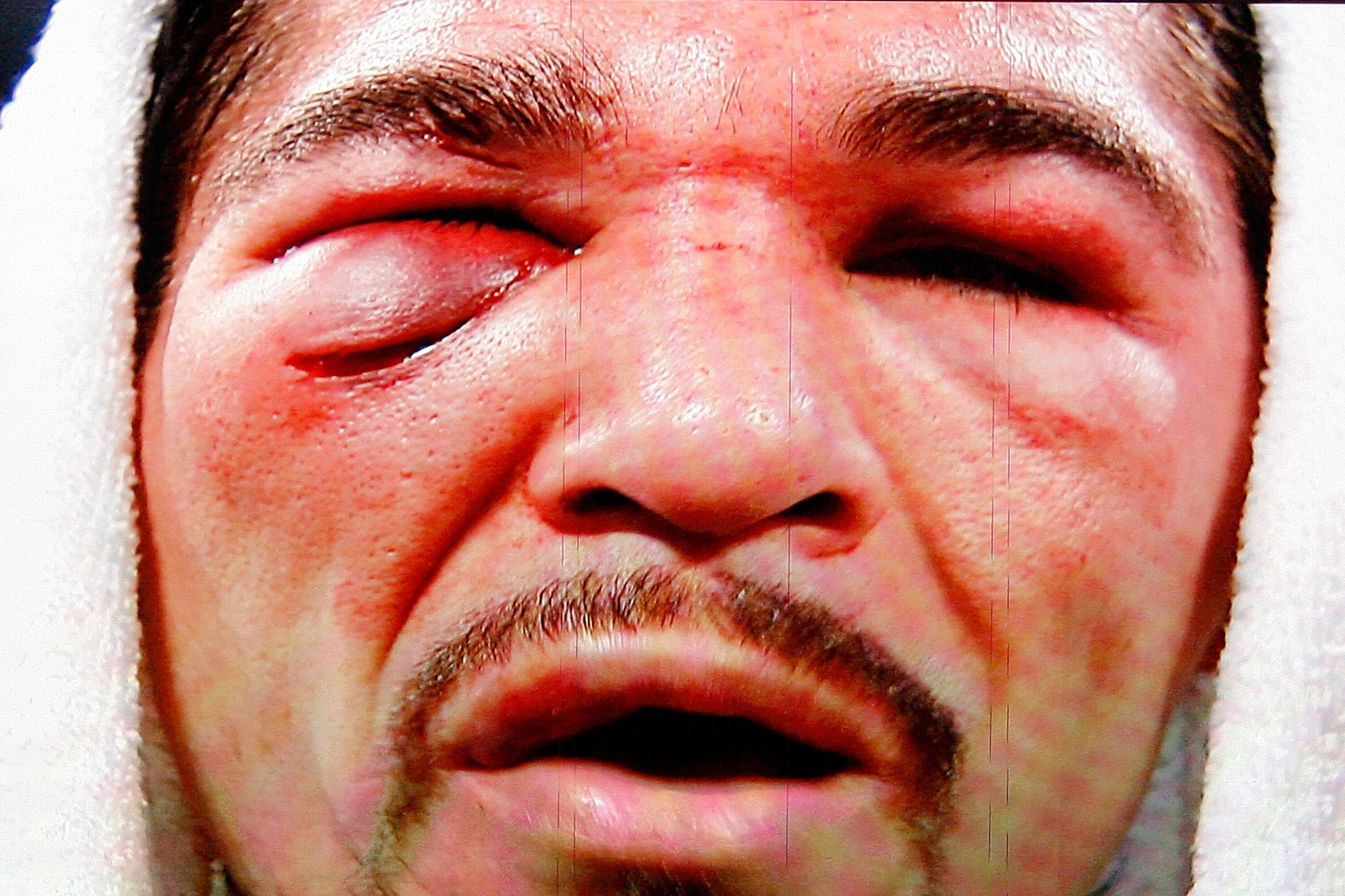 ARLINGTON, TX - NOVEMBER 13:  The likeness of Antonio Margarito (black trunks) of Mexico is seen on the giant screen as he is interviewed after he lost to Manny Pacquiao (white trunks) of the Philippines during their WBC World Super Welterweight Title bou