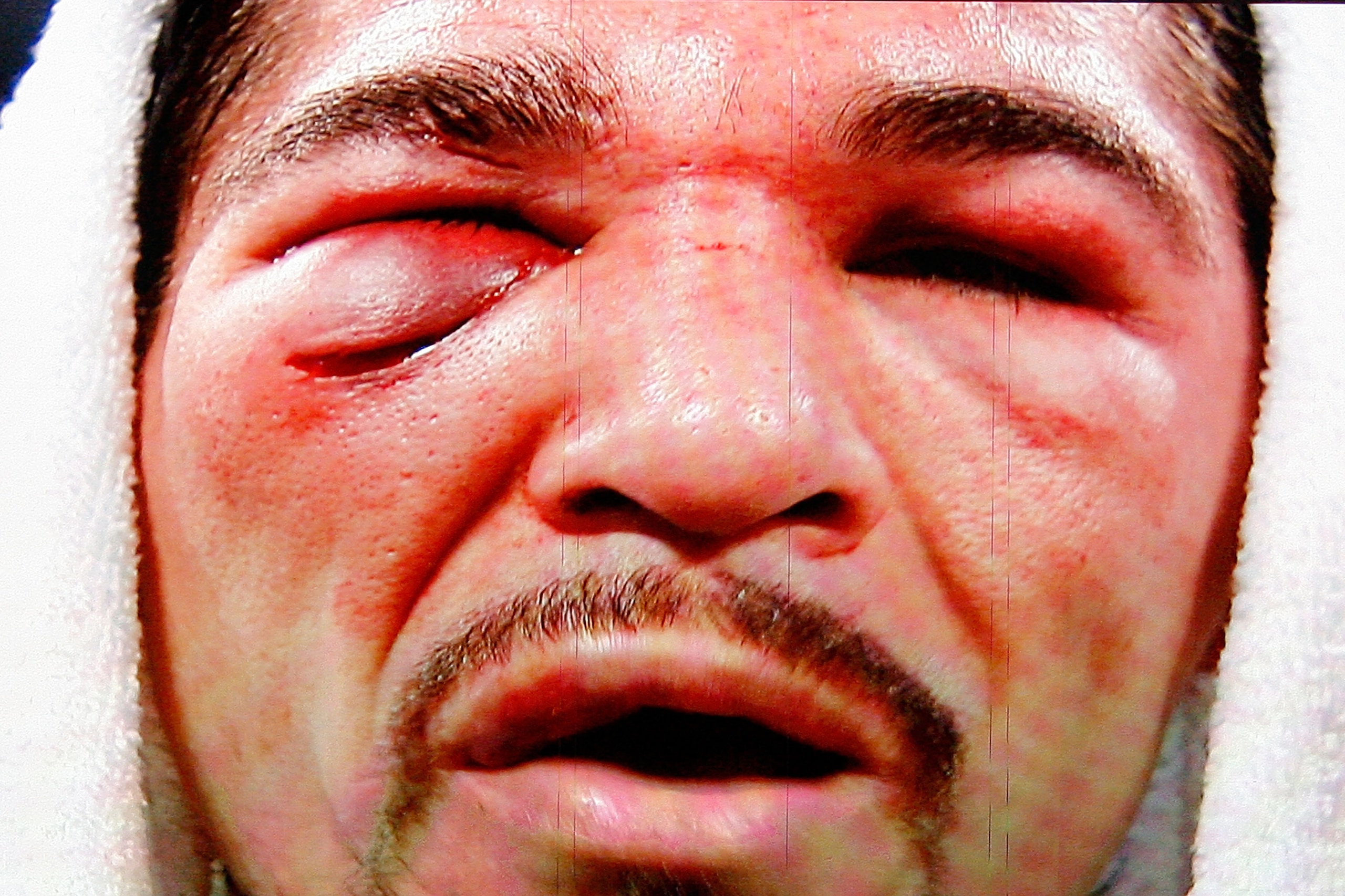 ARLINGTON, TX - NOVEMBER 13: The likeness of Antonio Margarito (black trunks) of Mexico is seen on the giant screen as he is interviewed after he lost to Manny Pacquiao (white trunks) of the Philippines during their WBC World Super Welterweight Title bou ARLINGTON, TX - NOVEMBER 13: The likeness of Antonio Margarito (black trunks) of Mexico is seen on the giant screen as he is interviewed after he lost to Manny Pacquiao (white trunks) of the Philippines during their WBC World Super Welterweight Title bou