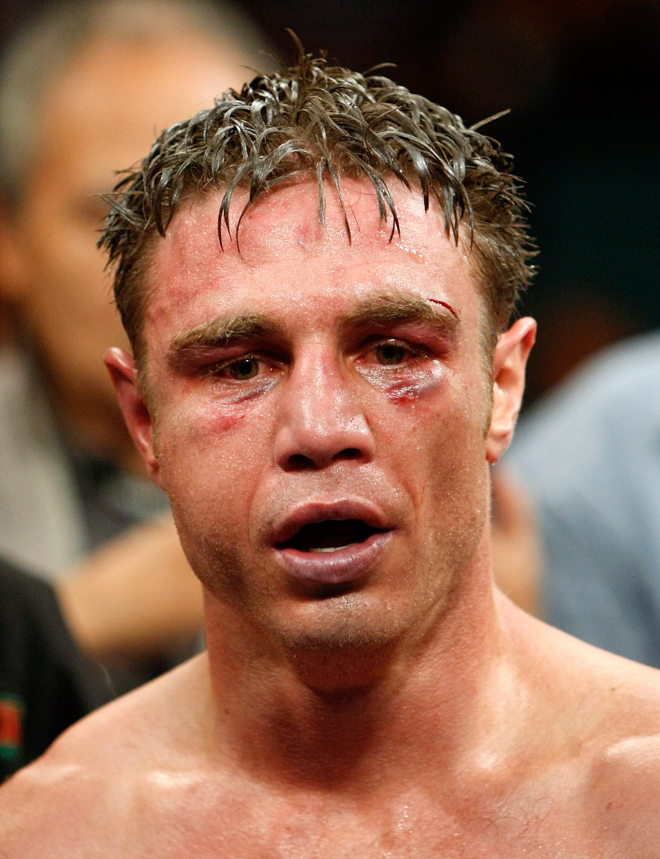 LAS VEGAS - SEPTEMBER 19:  Michael Katsidis appears after defeating Vincent Escobedo to win the WBO interim lightweight title at the MGM Grand Garden Arena September 19, 2009 in Las Vegas, Nevada. Katsidis won the fight by split decision.  (Photo by Ethan