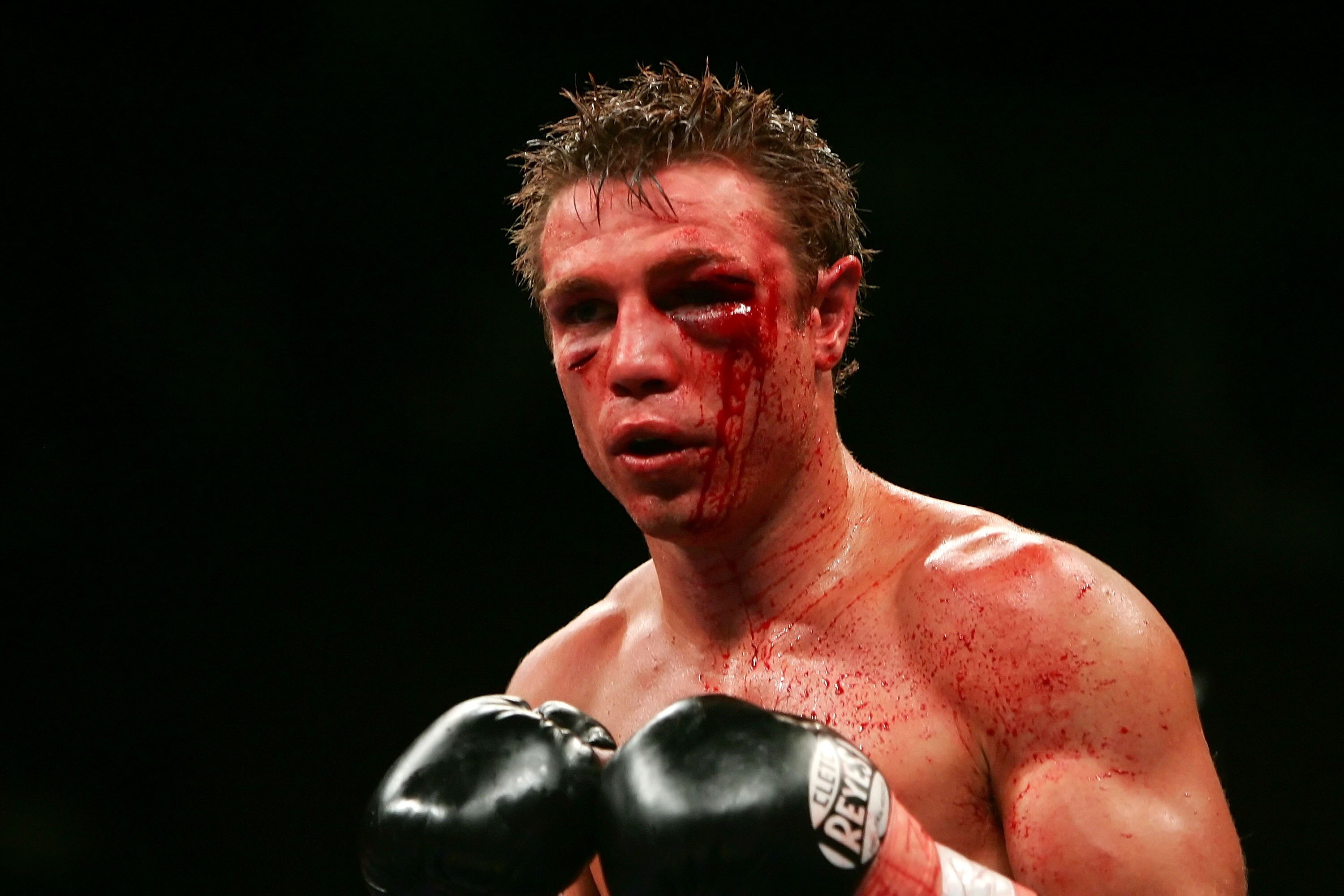 LAS VEGAS - JULY 21:  Michael Katsidis of Australia looks on during his fight against Czar Amonsot of the Philippines during their WBO interim lightweight championship fight at the Mandalay Bay Events Center July 21, 2007 in Las Vegas, Nevada.  (Photo by