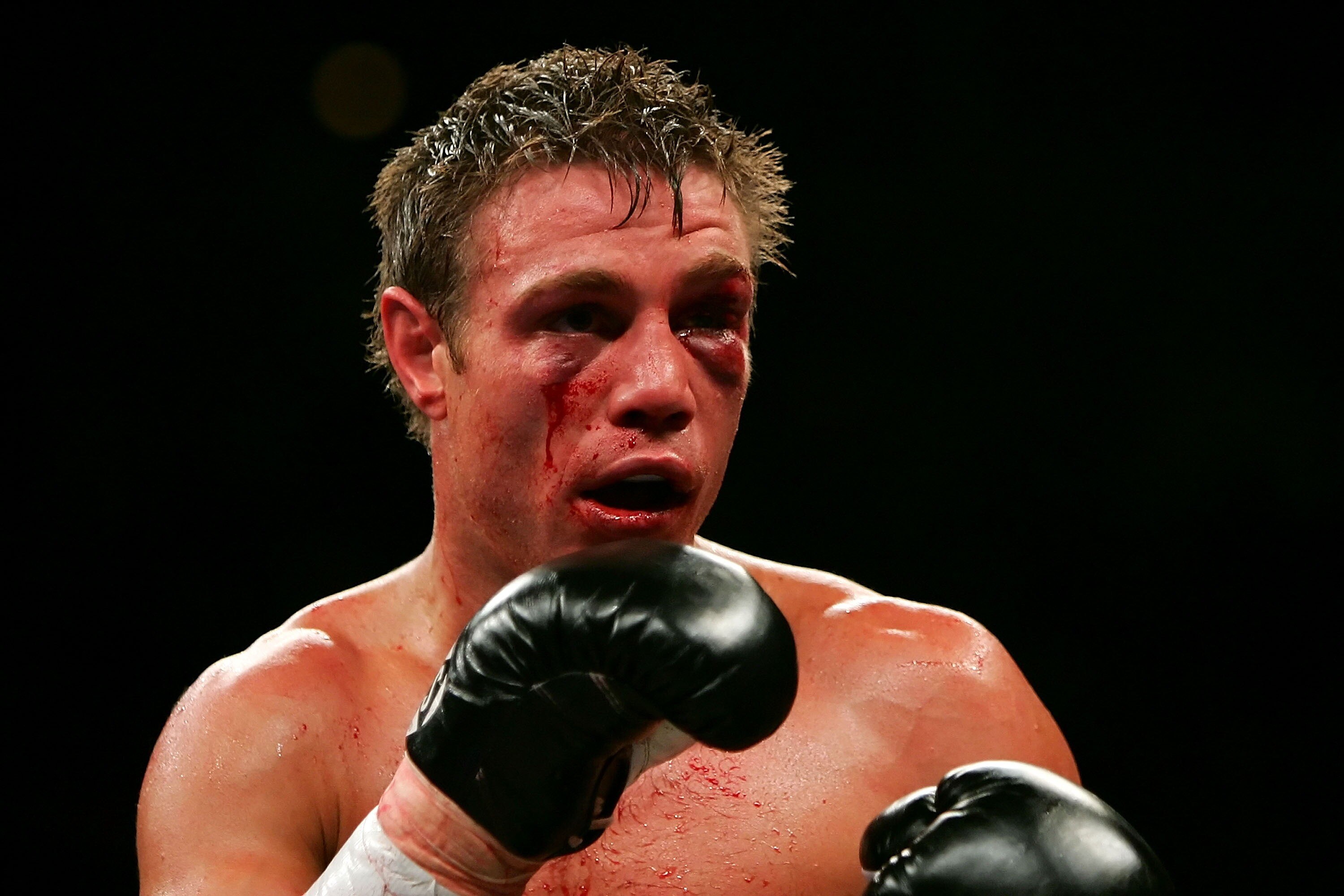 LAS VEGAS - JULY 21:  Michael Katsidis of Australia looks on during his fight against Czar Amonsot of the Philippines during their WBO interim lightweight championship fight at the Mandalay Bay Events Center July 21, 2007 in Las Vegas, Nevada.  (Photo by