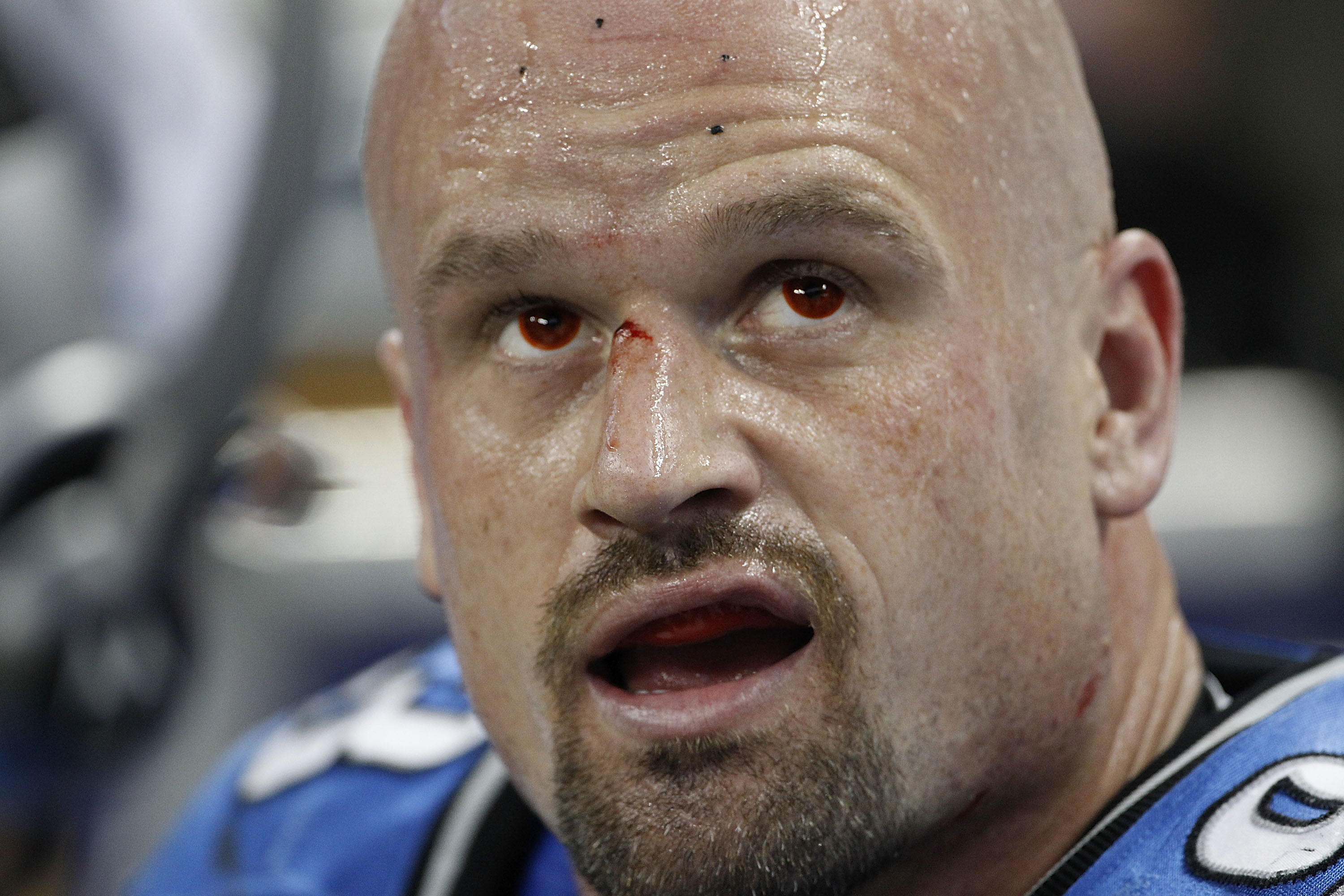 DETROIT - SEPTEMBER 19:  Kyle Vanden Bosch #93 of the Detroit Lions watches the video replay during the game against the Philadelphia Eagles at Ford Field on September 19, 2010 in Detroit, Michigan. The Eagles defeated the Lions 35-32.  (Photo by Leon Hal