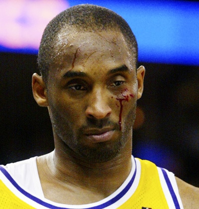 http://www.pe.com/sports/basketball/breakout/stories/PE_Sports_Local_B_lakers_25.44f3477.html