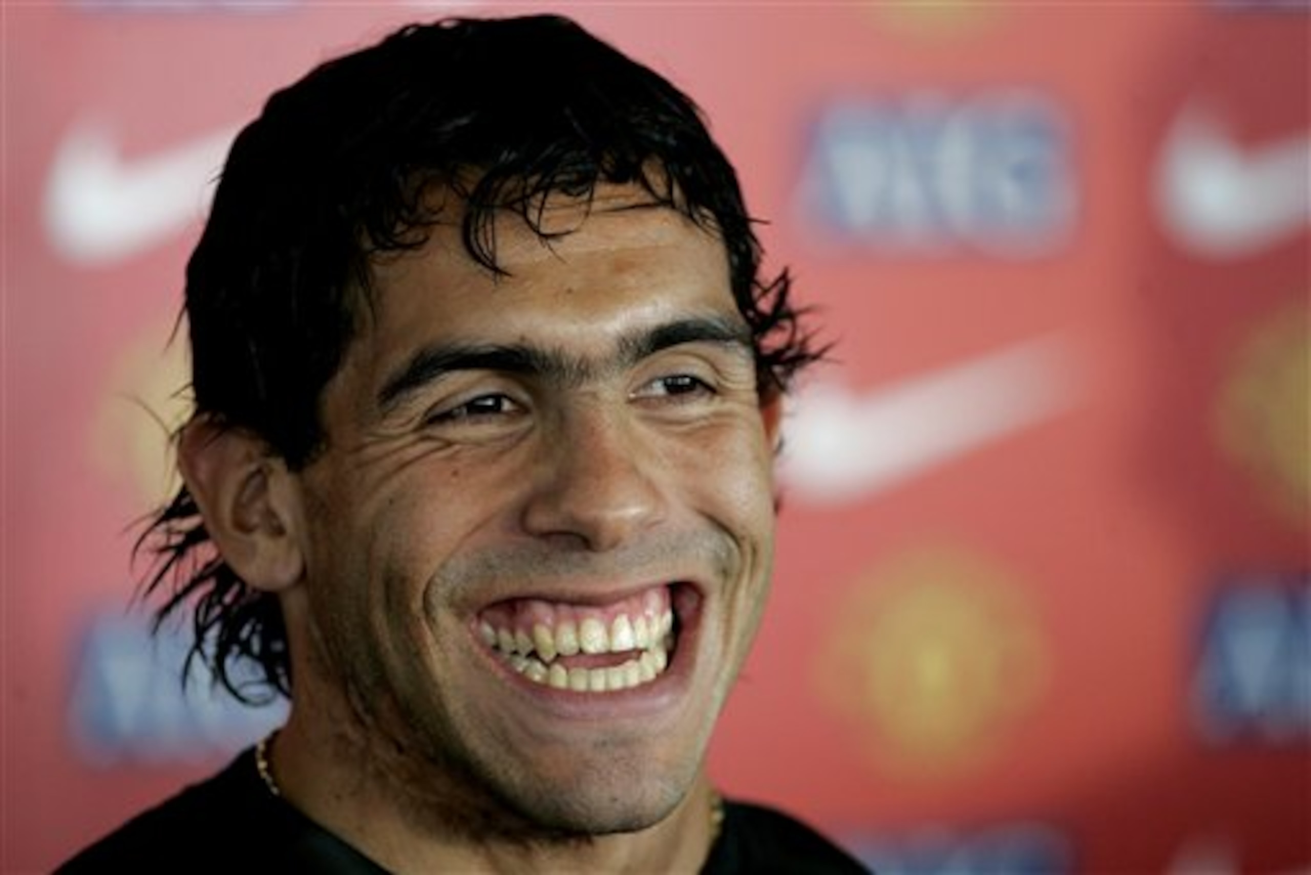 Ugly Teeth: Carlos Tevez
