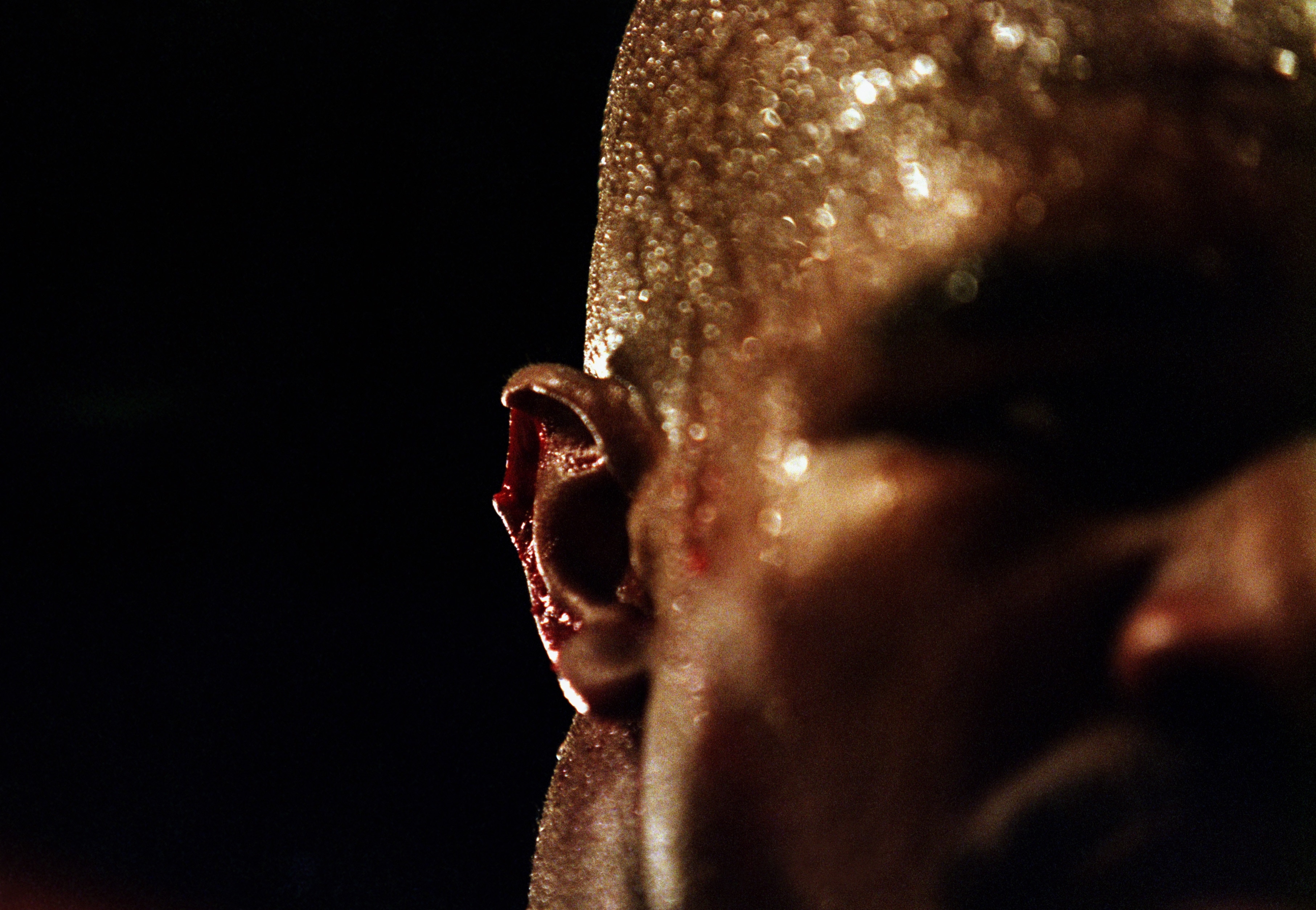 LAS VEGAS - JUNE 28:  A close-up of the injury to the right ear of Evander Holyfield of the USA after Mike Tyson Of the USA bit off a piece of it in the third round of their World Heavweight title fight on June 28, 1997 at the MGM Grand Garden in Las Vega