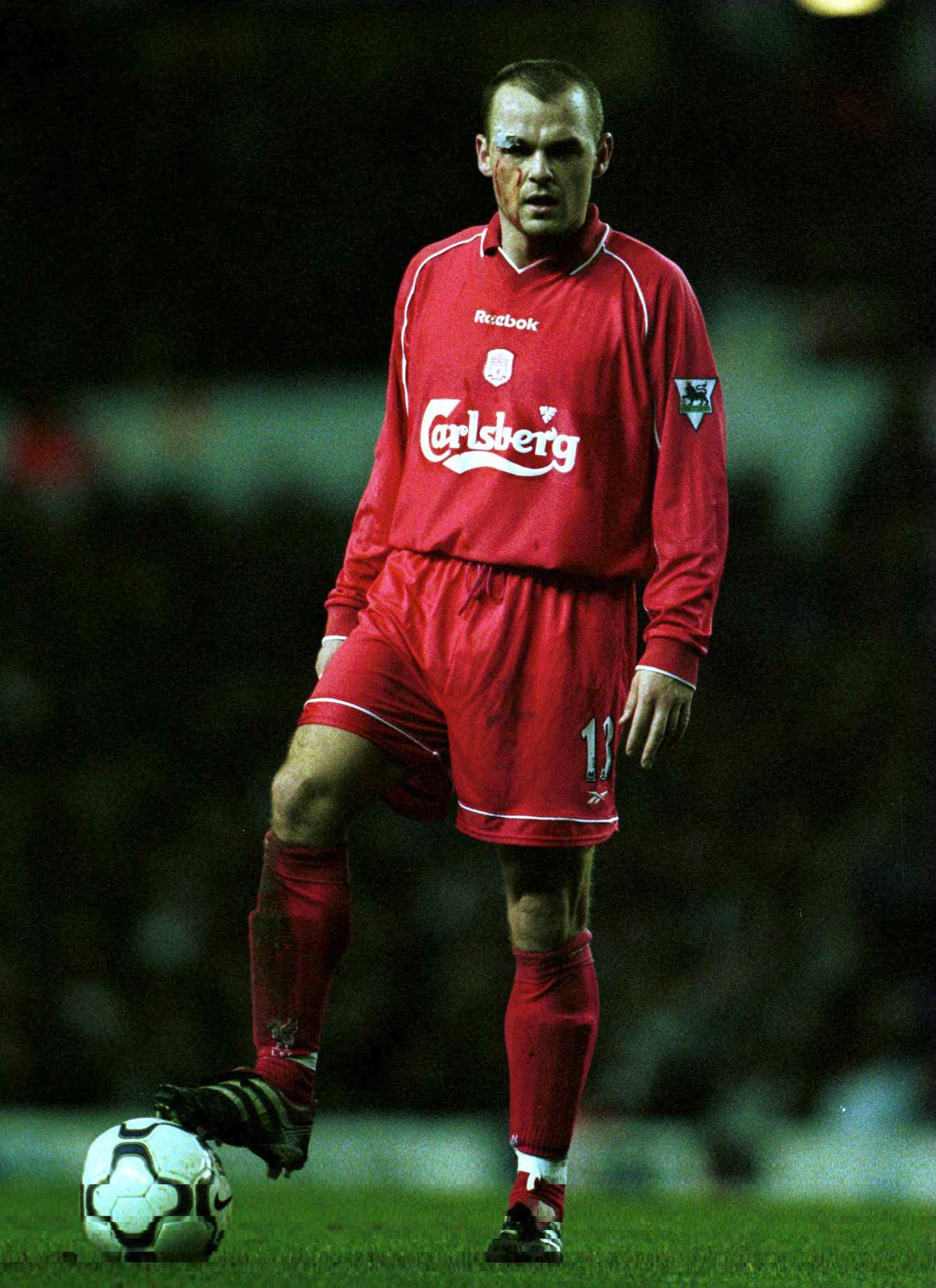 19 Nov 2000:  Danny Murphy of Liverpool with his face cut during the match between Tottenham Hotspur and Liverpool in the FA Carling Premiership at White Hart Lane, London.  Mandatory Credit: Mark Thompson/ALLSPORT