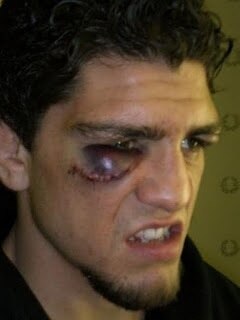 NickDiaz_original.jpg