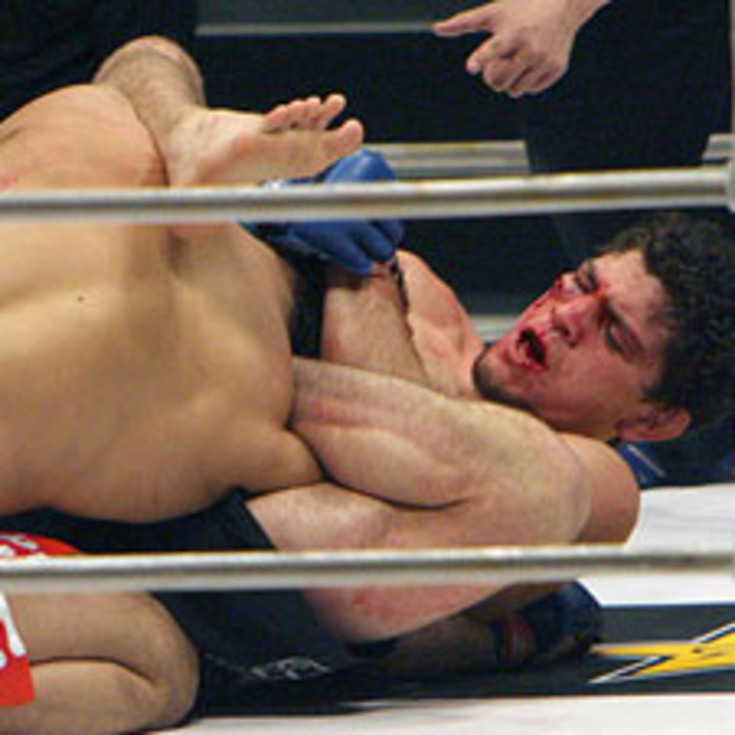 Nick Diaz's gogoplata of Takanori Gomi Nick Diaz's gogoplata of Takanori Gomi