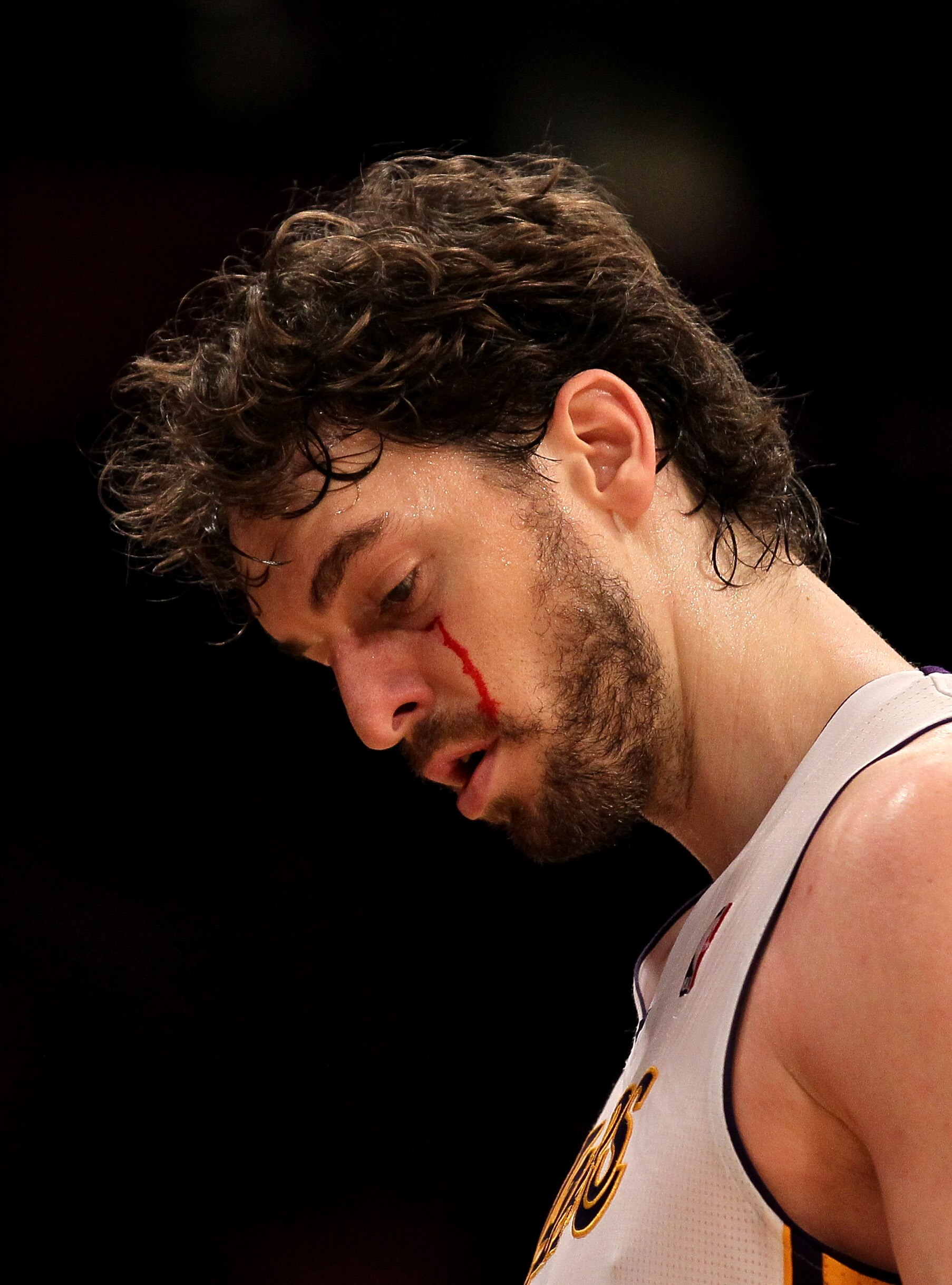 LOS ANGELES, CA - APRIL 17:  Pau Gasol #16 of the Los Angeles Lakers bleeds after being cut under the eye in the game against the New Orleans Hornets in Game One of the Western Conference Quarterfinals in the 2011 NBA Playoffs on April 17, 2011 at Staples
