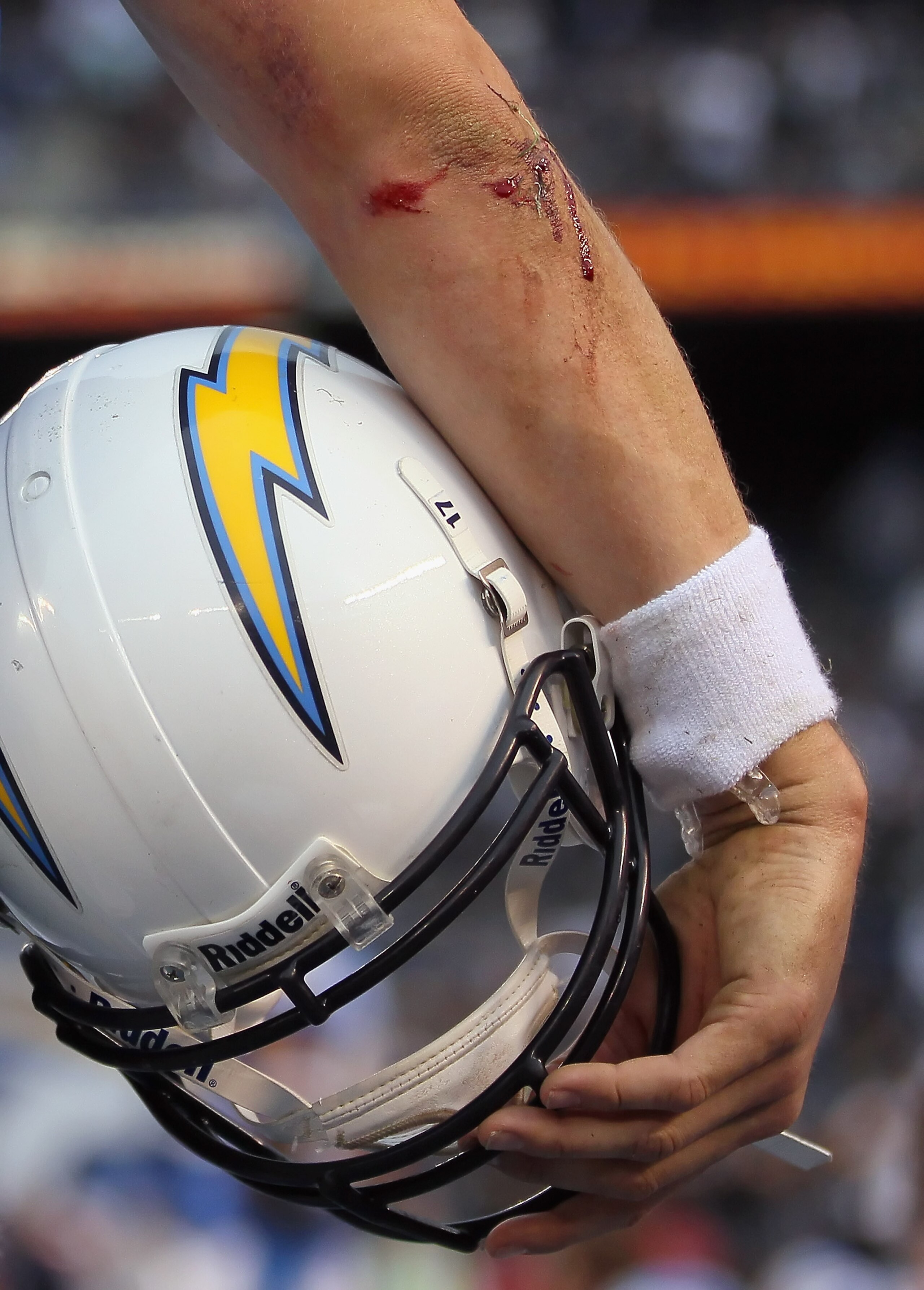 SAN DIEGO - DECEMBER 05:  The bloody elbow of quarterback Philip Rivers #17 of the San Diego Chargers is seen in the closing minutes of the fourth quarter against the Oakland Raiders at Qualcomm Stadium on December 5, 2010 in San Diego, California. The Ra