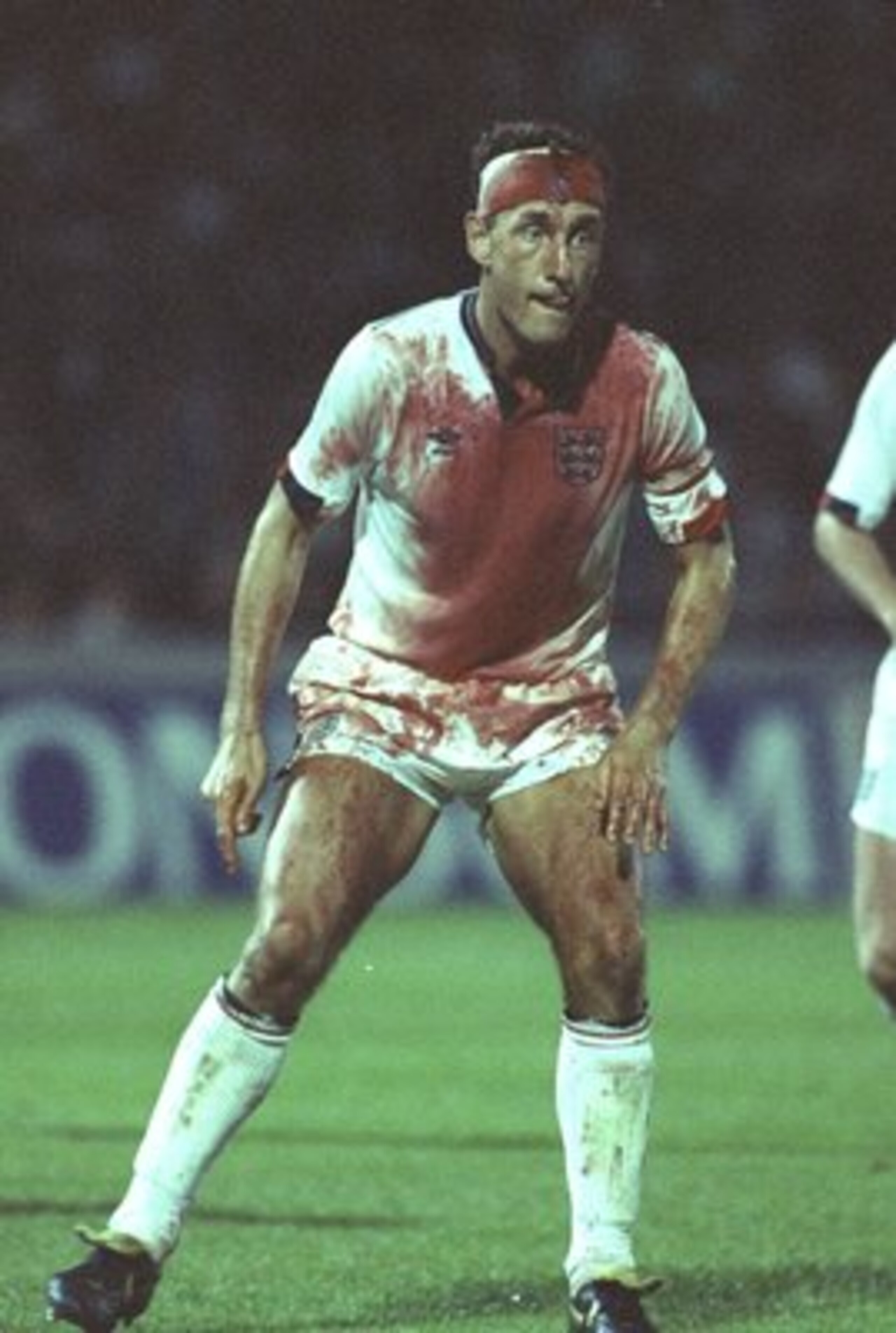 6 Sep 1989:  A bloody Terry Butcher in action during the World Cup Qualifier against Sweden at Stockholm, Sweden. The game was drawn 0-0. \ Mandatory Credit: David Cannon /Allsport