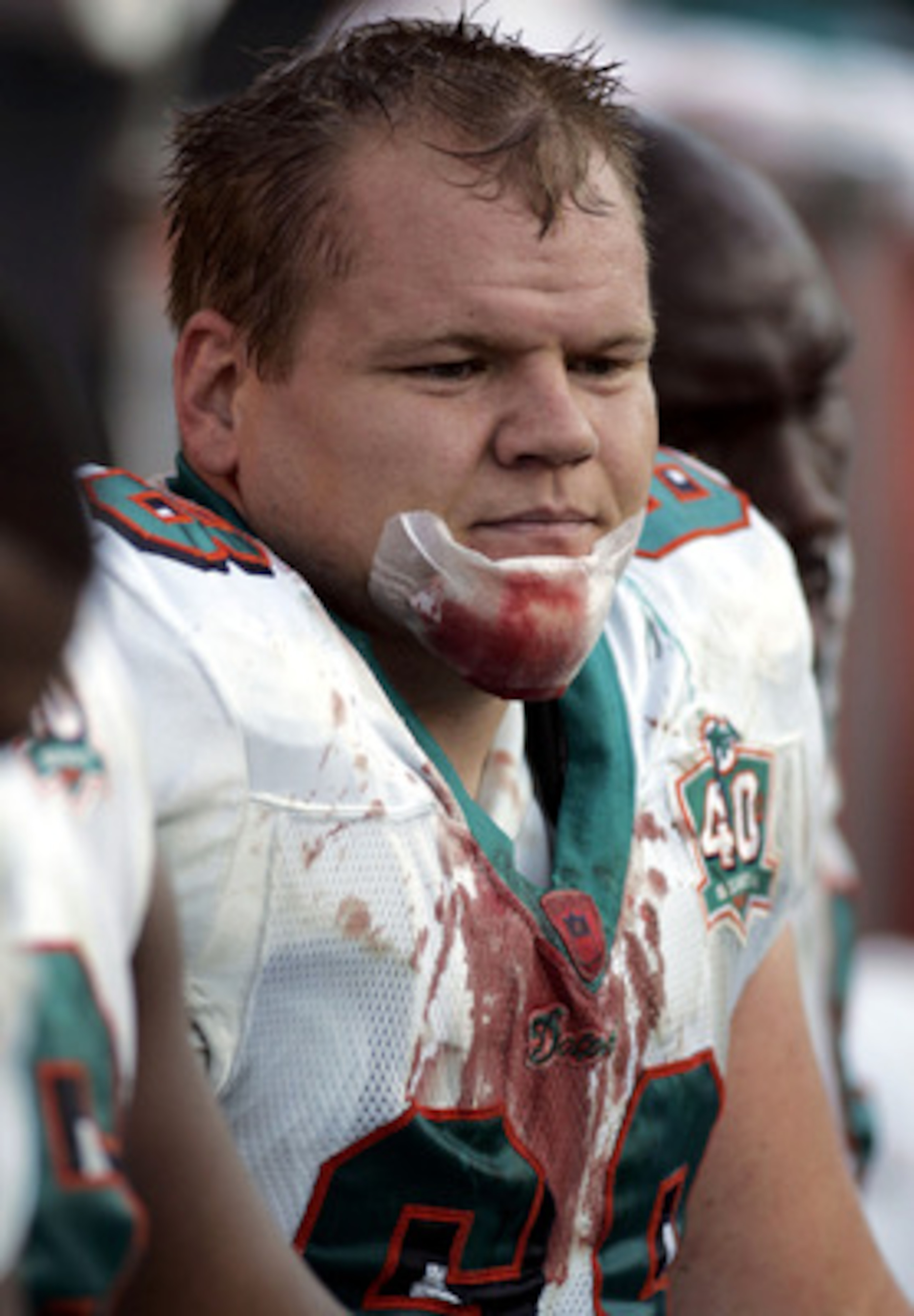 BATON ROUGE, LA - OCTOBER 30: Seth McKinney #68 of the Miami Dolphins sits on the sideline after cutting his chin during a game against the New Orleans Saints at Tiger Stadium on the Louisiana State University campus in Baton Rouge, Louisiana on October BATON ROUGE, LA - OCTOBER 30: Seth McKinney #68 of the Miami Dolphins sits on the sideline after cutting his chin during a game against the New Orleans Saints at Tiger Stadium on the Louisiana State University campus in Baton Rouge, Louisiana on October