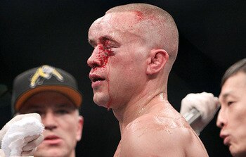 Credit: MMAFighting.com