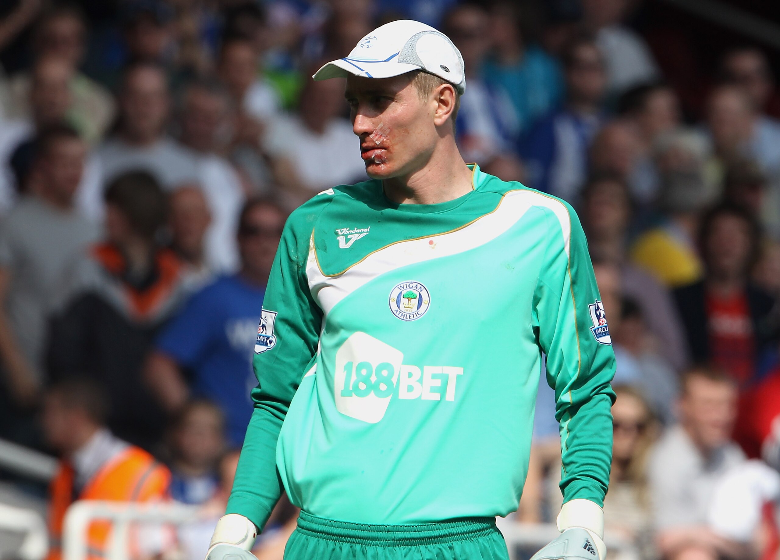 LONDON, ENGLAND - APRIL 24:  Chris Kirkland of Wigan with plasters on his face after being injured by Carlton Cole of West Ham during the Barclays Premier League match between West Ham United and Wigan Athletic at the Boleyn Ground on April 24, 2010 in Lo
