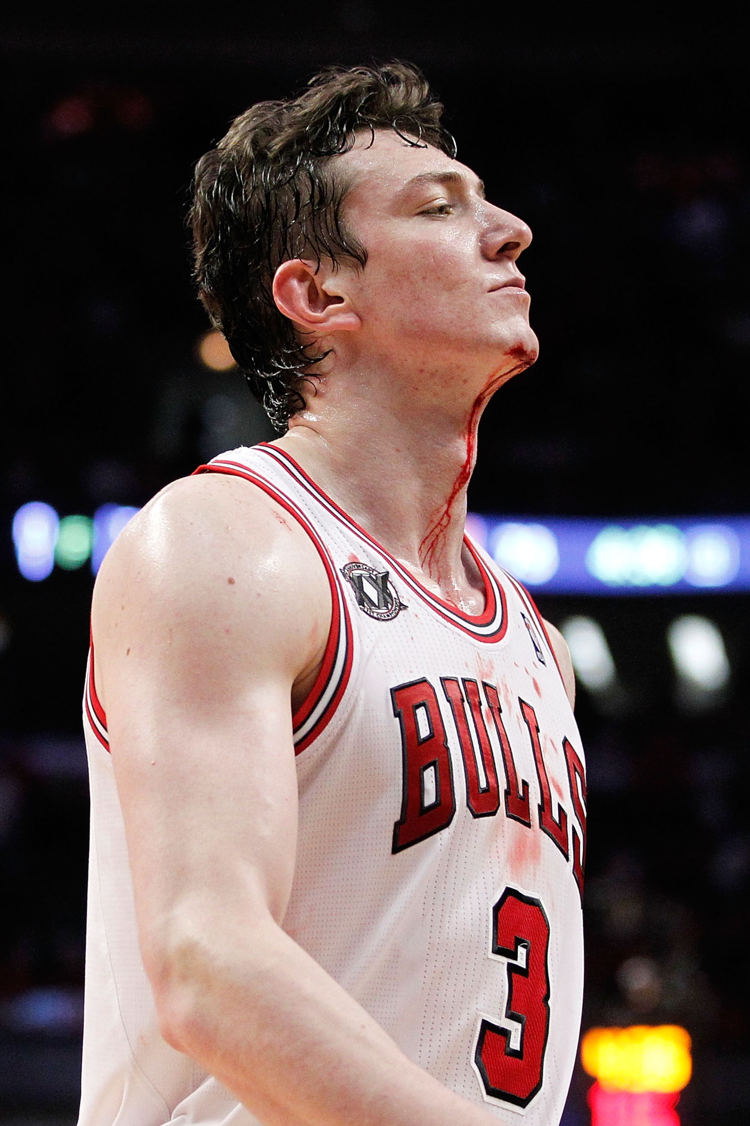 CHICAGO, IL - MAY 18:  Blood drips from the neck of Omer Asik #3 of the Chicago Bulls after he drew contact against the Miami Heat in Game Two of the Eastern Conference Finals during the 2011 NBA Playoffs on May 18, 2011 at the United Center in Chicago, I