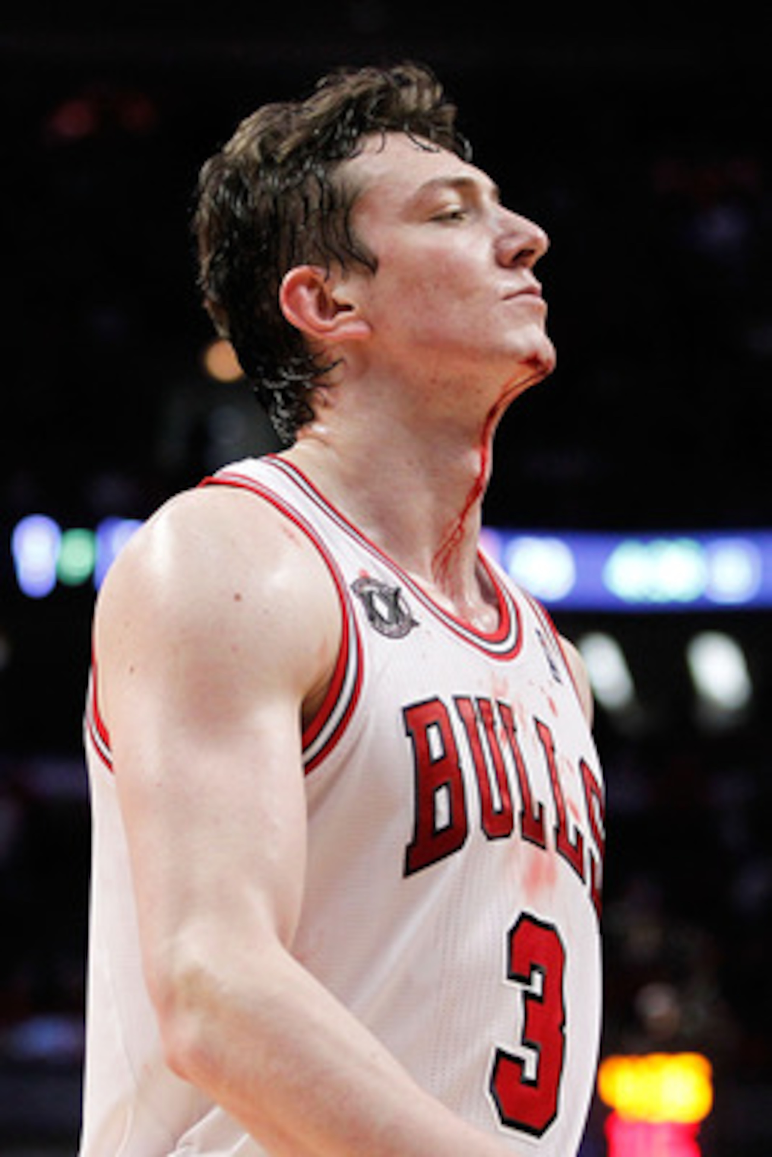 CHICAGO, IL - MAY 18:  Blood drips from the neck of Omer Asik #3 of the Chicago Bulls after he drew contact against the Miami Heat in Game Two of the Eastern Conference Finals during the 2011 NBA Playoffs on May 18, 2011 at the United Center in Chicago, I