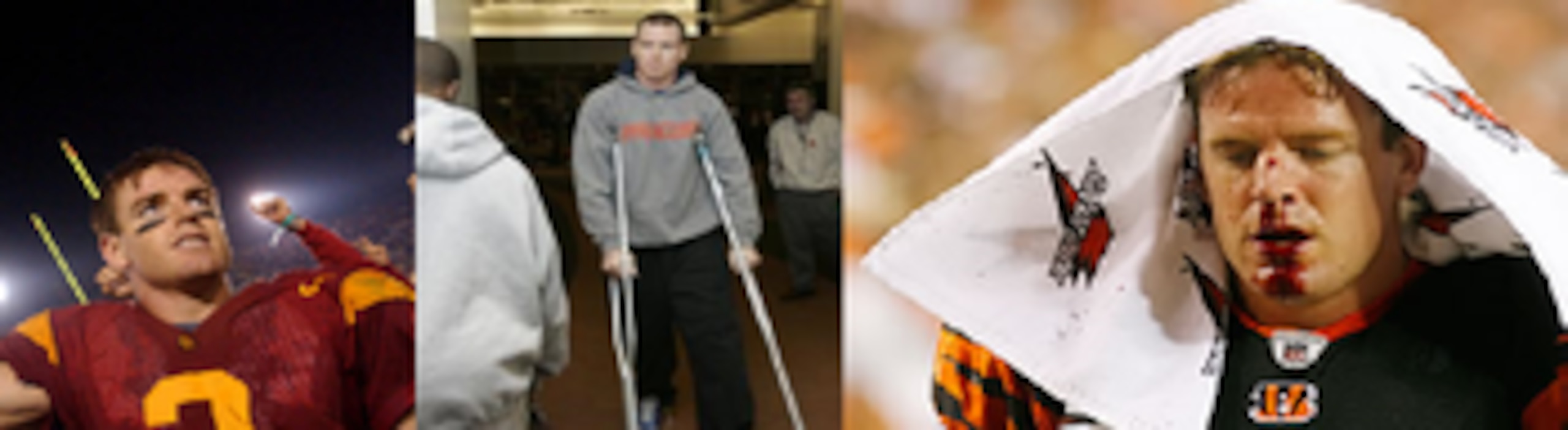 The evolution of Carson Palmer