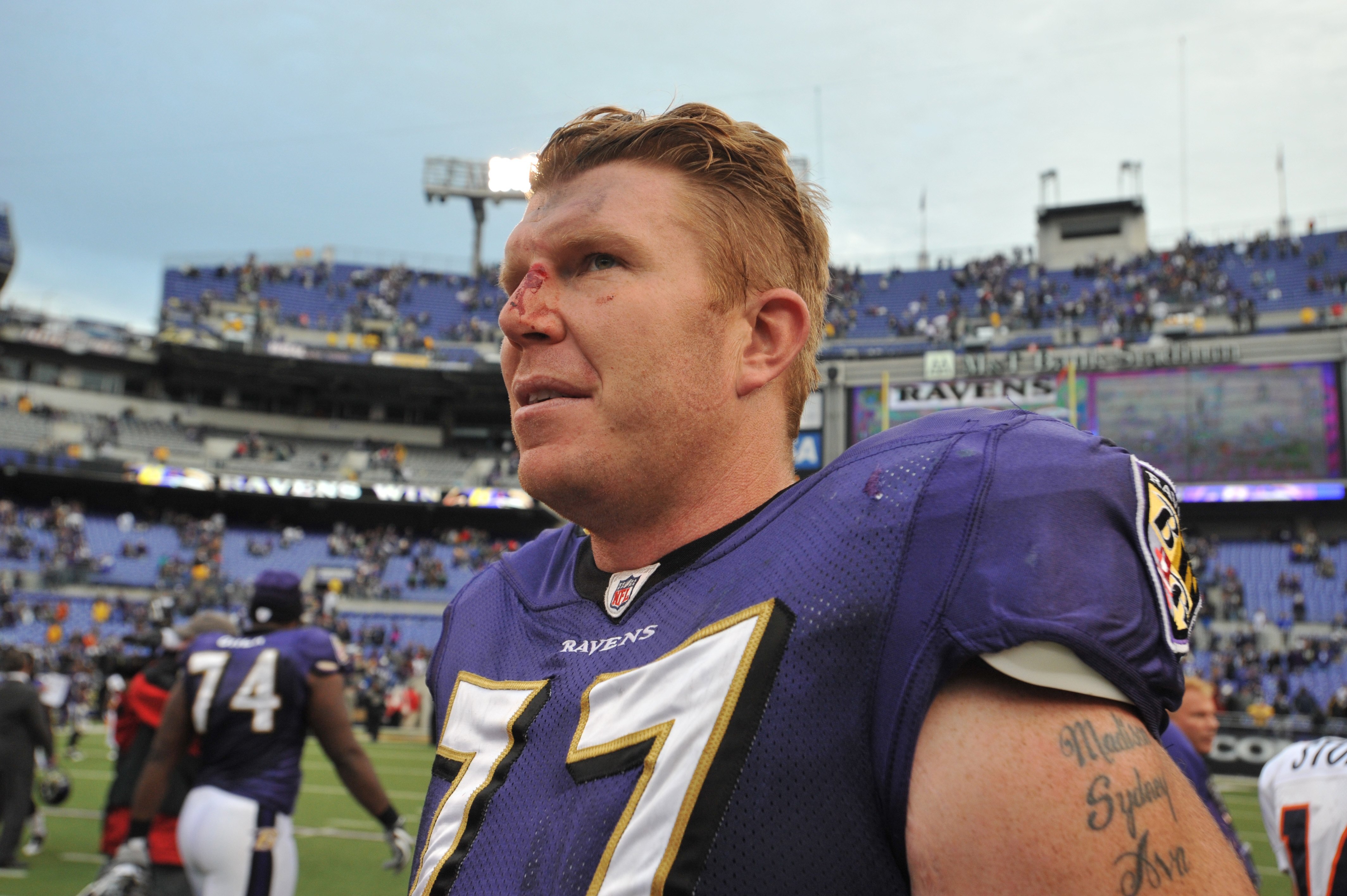 BALTIMORE - NOVEMBER 1:  Matt Birk #77 of the Baltimore Ravens bleeds from a cut on his nose after the game against the Denver Broncos at M&T Bank Stadium on November 1, 2009 in Baltimore, Maryland. The Ravens defeated the Broncos 30-7. (Photo by Larry Fr