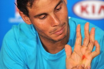 MELBOURNE, AUSTRALIA - JANUARY 20:  Rafael Nadal of Spain shows his blistered hand during a press conference after he won his fourth round match against Kei Nishikori of Japan during day eight of the 2014 Australian Open at Melbourne Park on January 20, 2