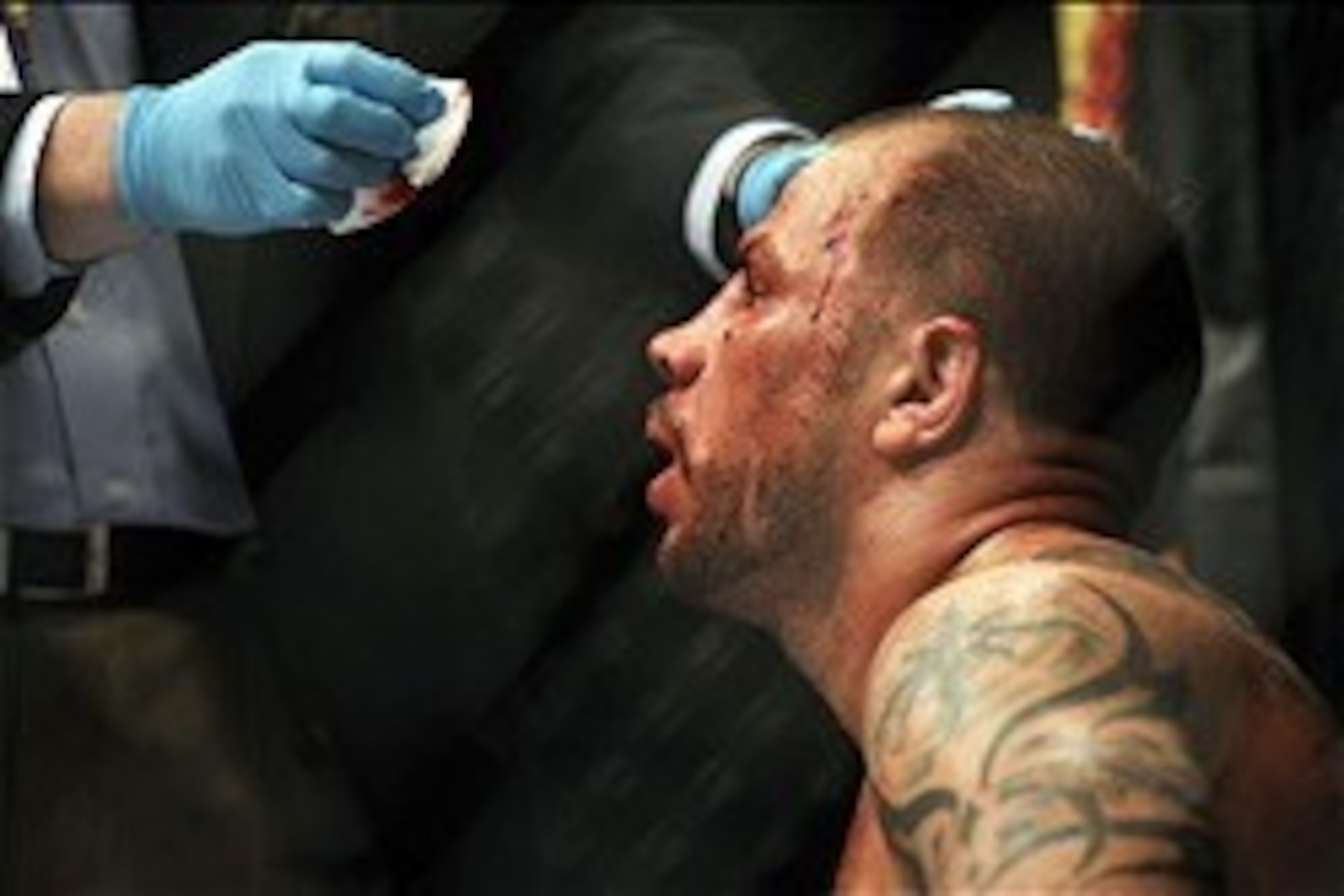 Jun 22, 2012; Atlantic City, NJ, USA; Nick Catone has blood wiped from his forehead in a middleweight bout against Chris Camozziduring UFC on FX at Revel Resort and Casino.  Chris Camozzi won the fight by technical knockout in in the third round.  Mandato