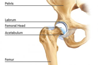 The hip labrum is a ring of cartilage that encircles the acetabulum—or hip socket. It helps support the femur, or thigh bone, where it meets the pelvis.