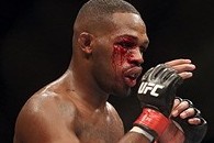 Sep 21, 2013; Toronto, Ontario, CAN; Blood bleeds from a cut on the eye of Jon Jones during his fight against Alexander Gustafsson (not pictured) during their light heavyweight championship bout at UFC 165 at the Air Canada Centre. Mandatory Credit: Tom S