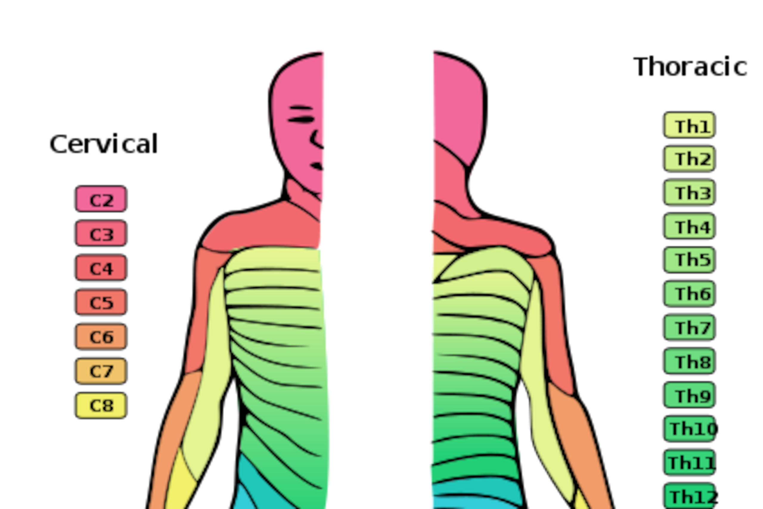 A "dermatome" describes an area of the skin whose sensation is supplied by a specific nerve root. For instance, the C4 and C5 nerve roots—coming out of the spinal cord from just above the C4 and C5 vertebrae, respectively—provide sensation to the shoulder and upper arm. Interruption of the C4 or C5 root by a herniated disc may cause numbness in its corresponding dermatome.