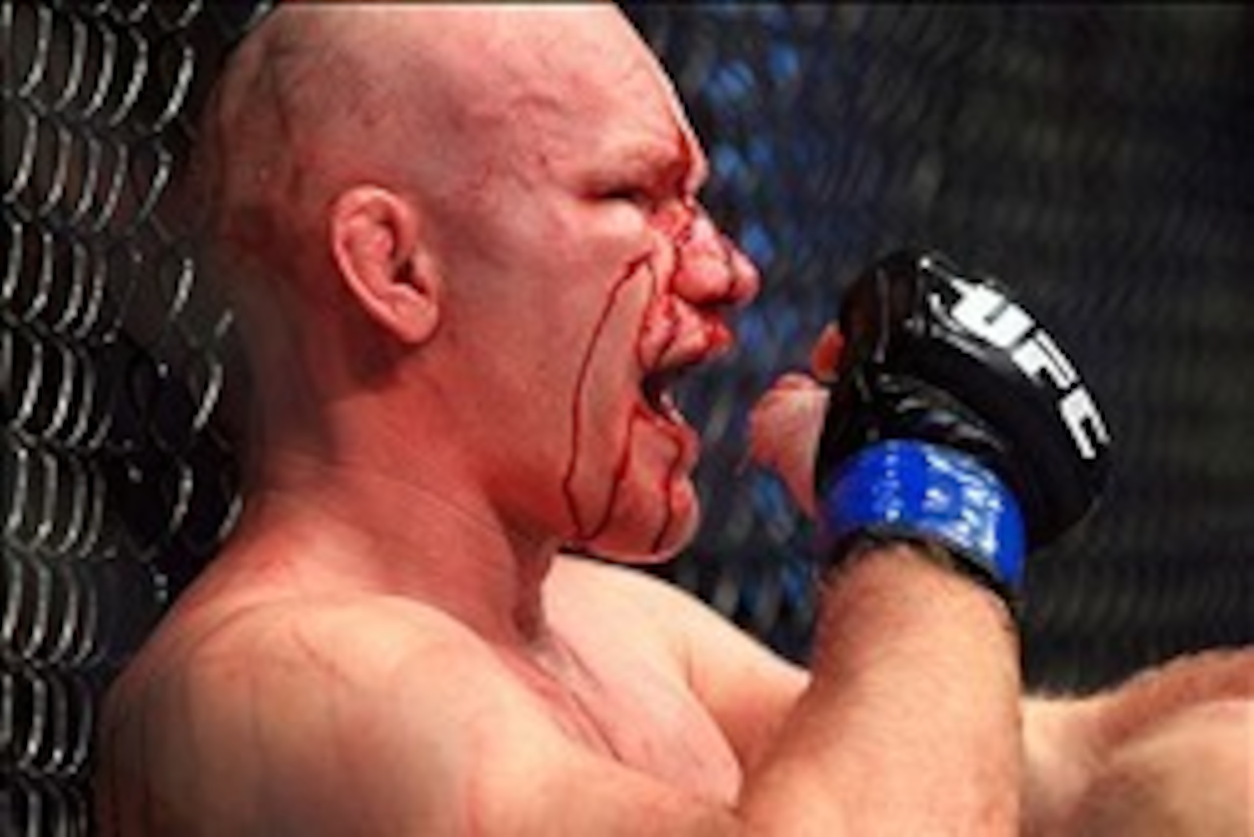 Aug 28, 2013; Indianapolis, IN, USA; Blood drips from a cut on the face of Martin Kampmann during UFC Fight Night 27 against Carlos Condit at Bankers Life Fieldhouse. Mandatory Credit: Pat Lovell-USA TODAY Sports