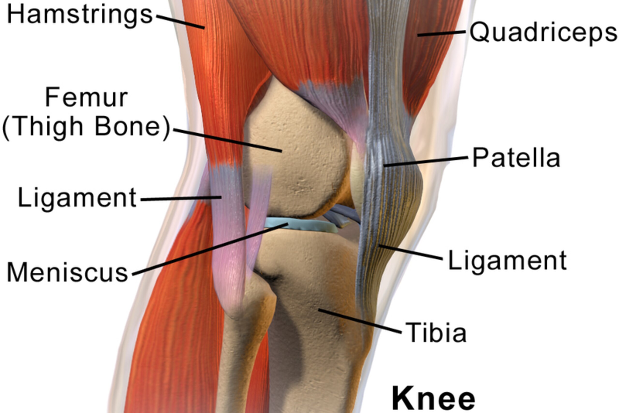 During arthroscopic knee surgery, a surgeon can visualize and treat many different problems—such as meniscal tears. During arthroscopic knee surgery, a surgeon can visualize and treat many different problems—such as meniscal tears.