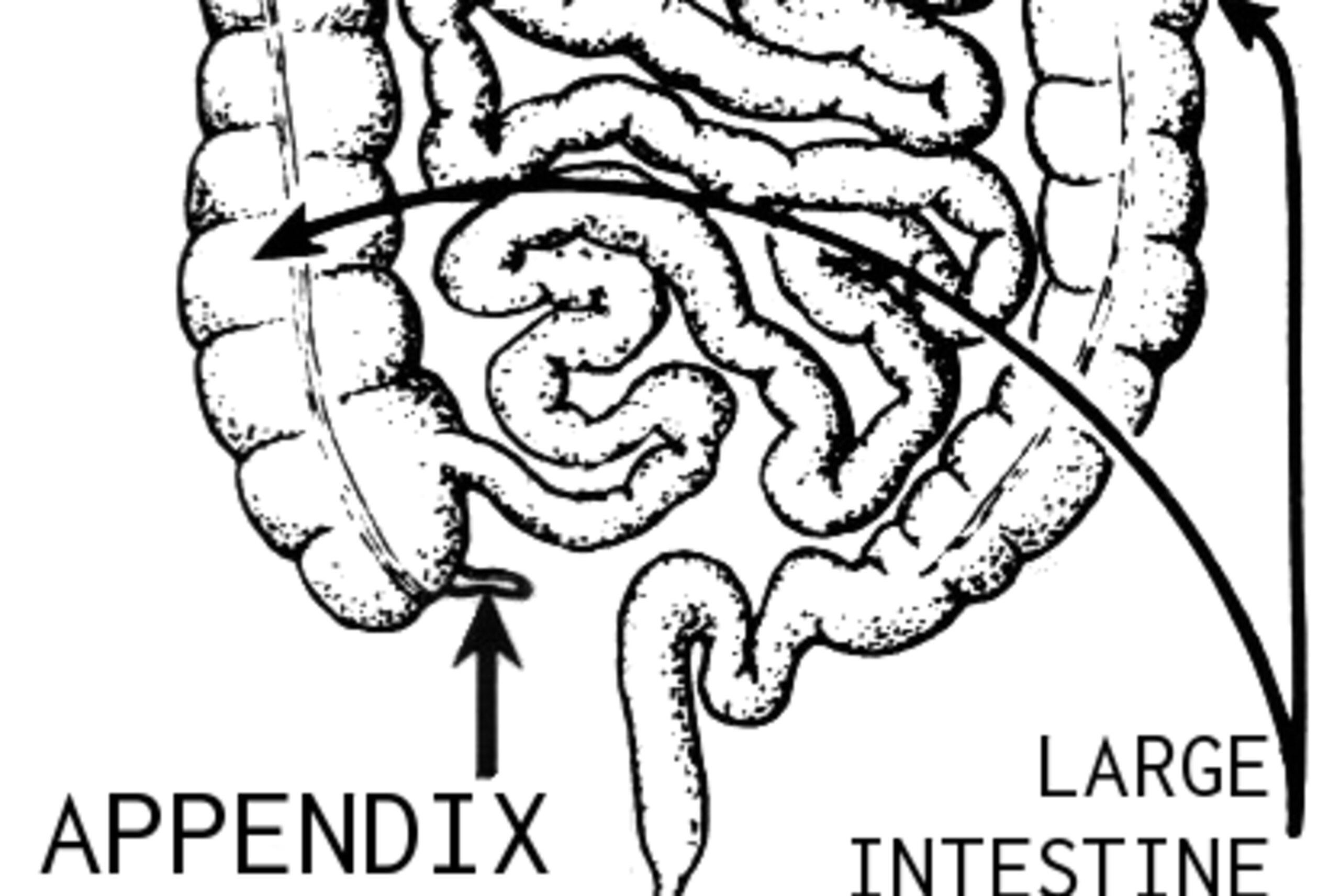 This diagram shows a crude representation of the intestines within the lower abdomen as viewed from the front. It shows the location, shape and relative size of the appendix.