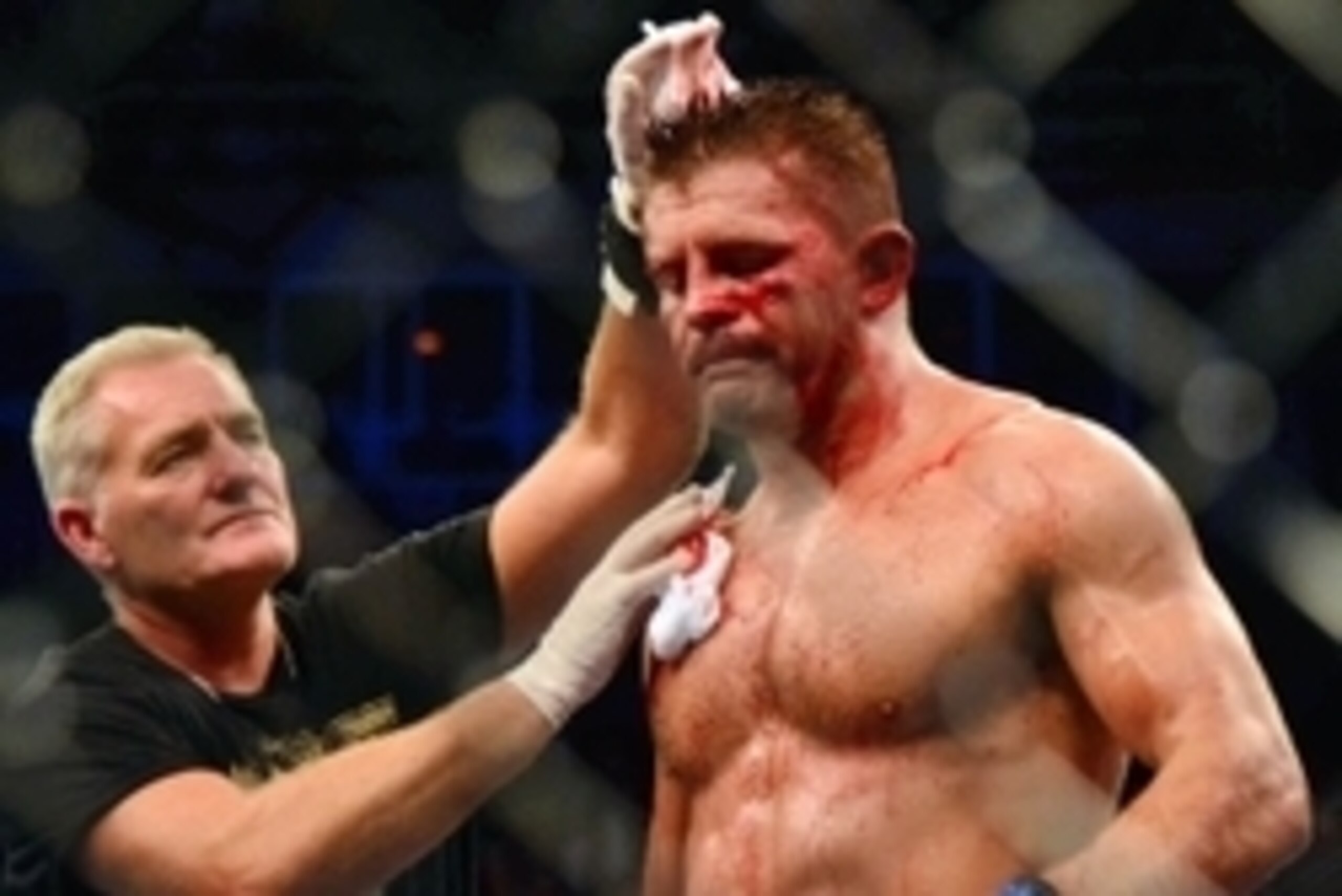 Aug 3, 2013; Rio De Janeiro, Brazil; Tom Watson gets treatment for a cut during his fight against Thales Leites during UFC 163 at HSBC Arena. Mandatory Credit: Jason Silva-USA TODAY Sports