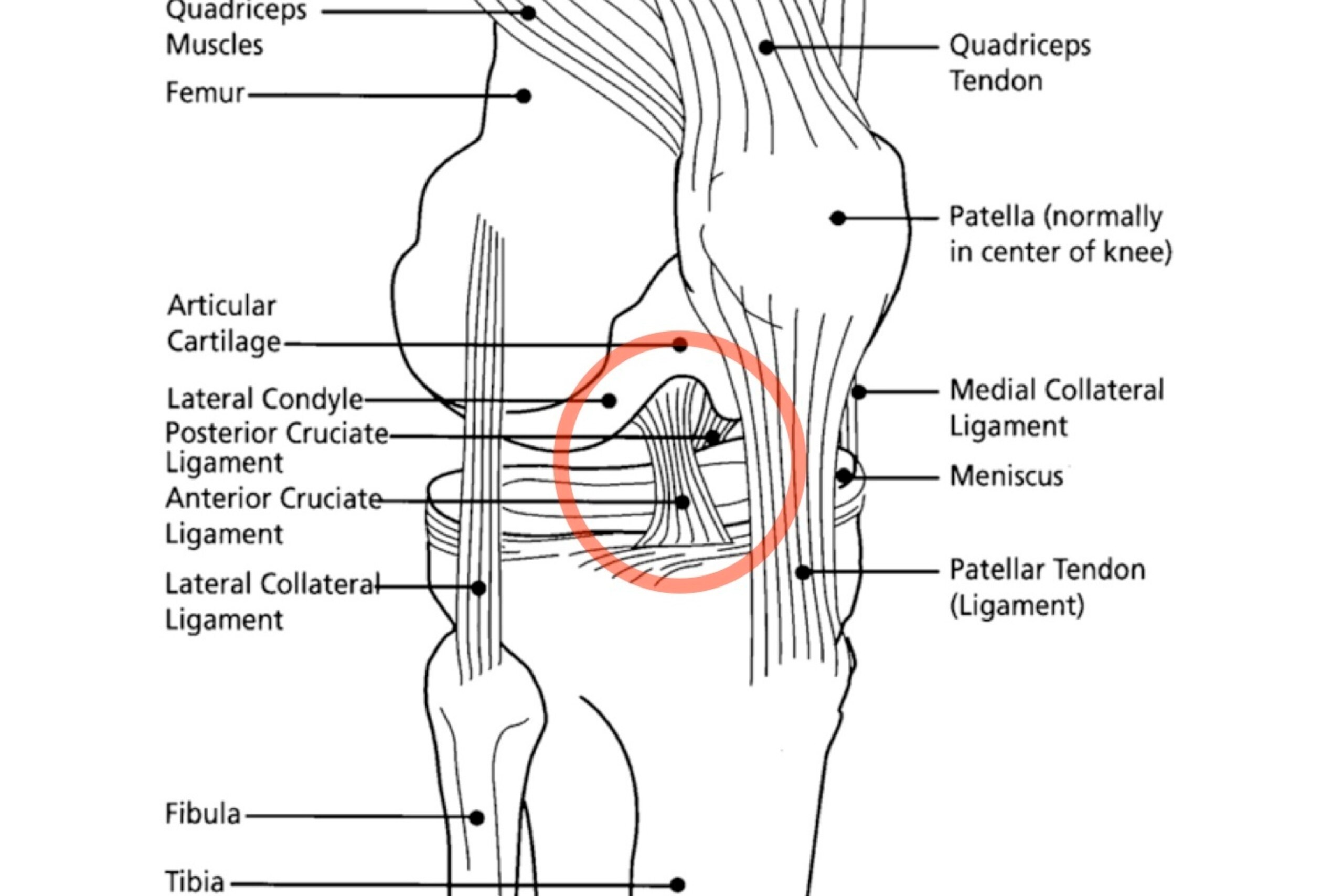 This diagram shows the basic anatomy of the knee as viewed from the front and outside. The red circle highlights the location of the ACL.