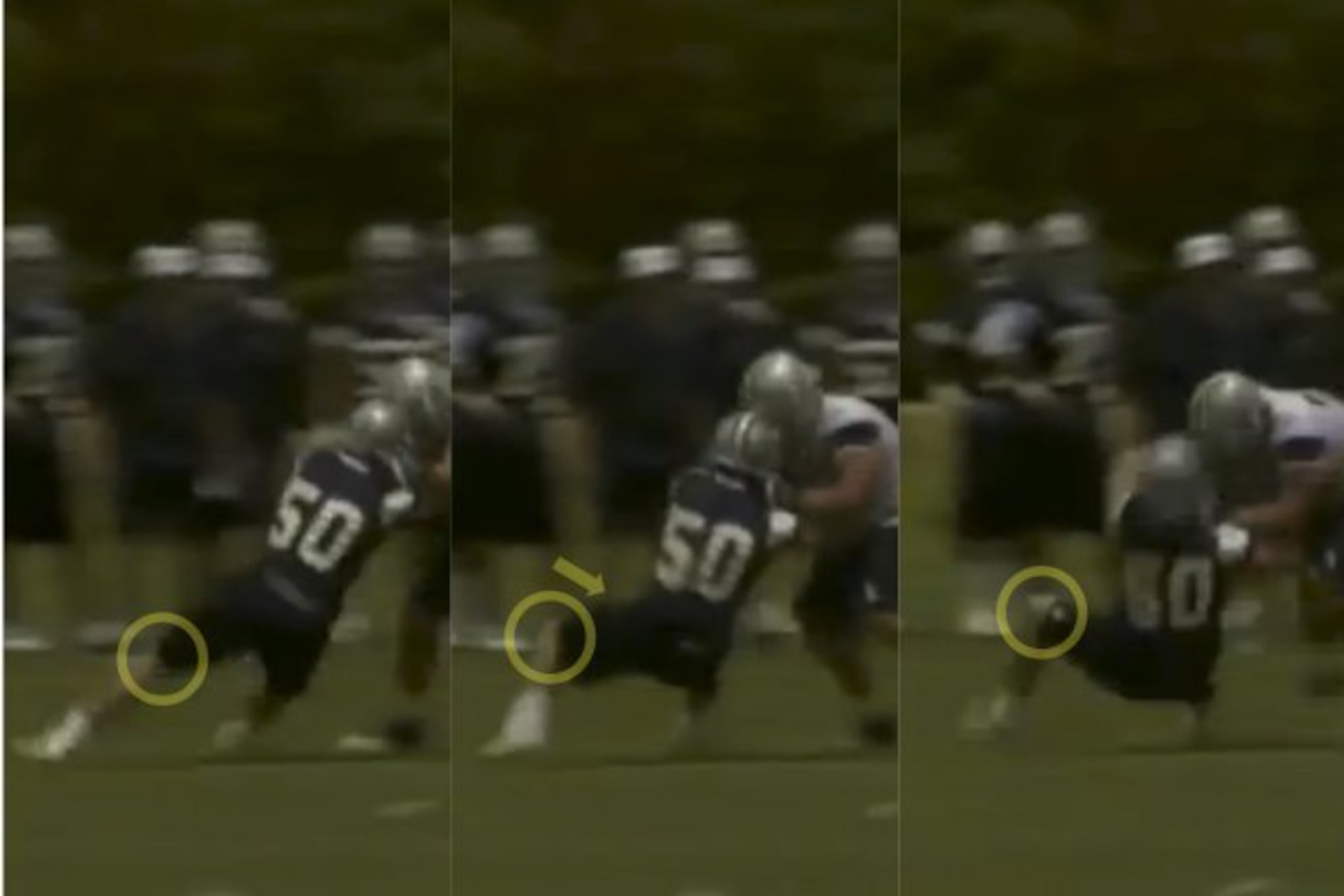 Sean Lee suffered a non-contact ACL tear in May. The yellow arrow highlights the relative inward motion of his knee compared to the rest of his body.
