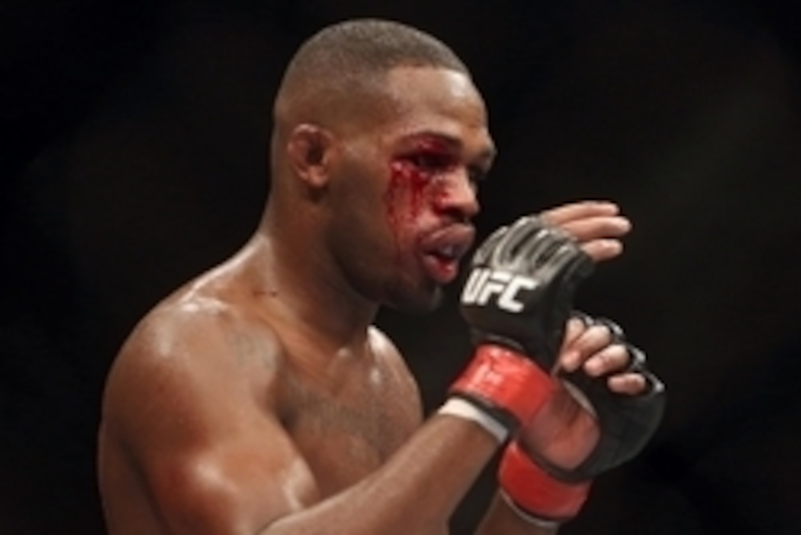 Sep 21, 2013; Toronto, Ontario, CAN; Blood bleeds from a cut on the eye of Jon Jones during his fight against Alexander Gustafsson (not pictured) during their light heavyweight championship bout at UFC 165 at the Air Canada Centre. Mandatory Credit: Tom S Sep 21, 2013; Toronto, Ontario, CAN; Blood bleeds from a cut on the eye of Jon Jones during his fight against Alexander Gustafsson (not pictured) during their light heavyweight championship bout at UFC 165 at the Air Canada Centre. Mandatory Credit: Tom S
