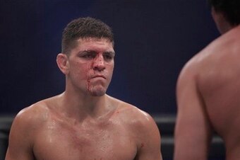 Nick Diaz