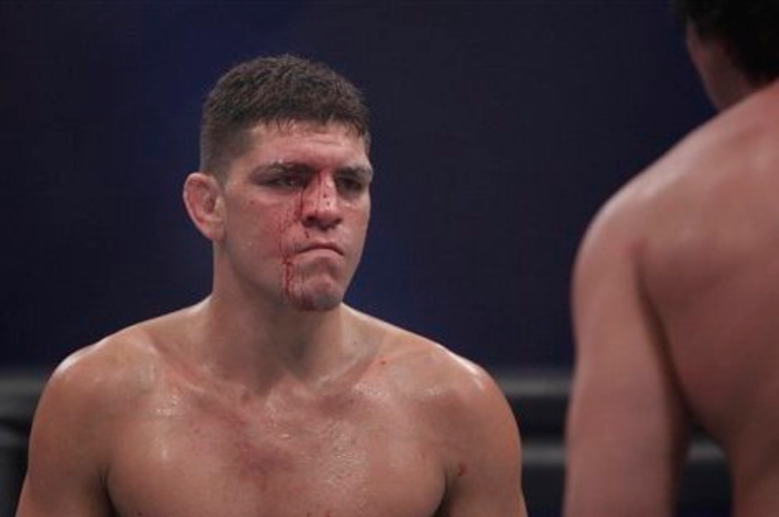 Nick Diaz