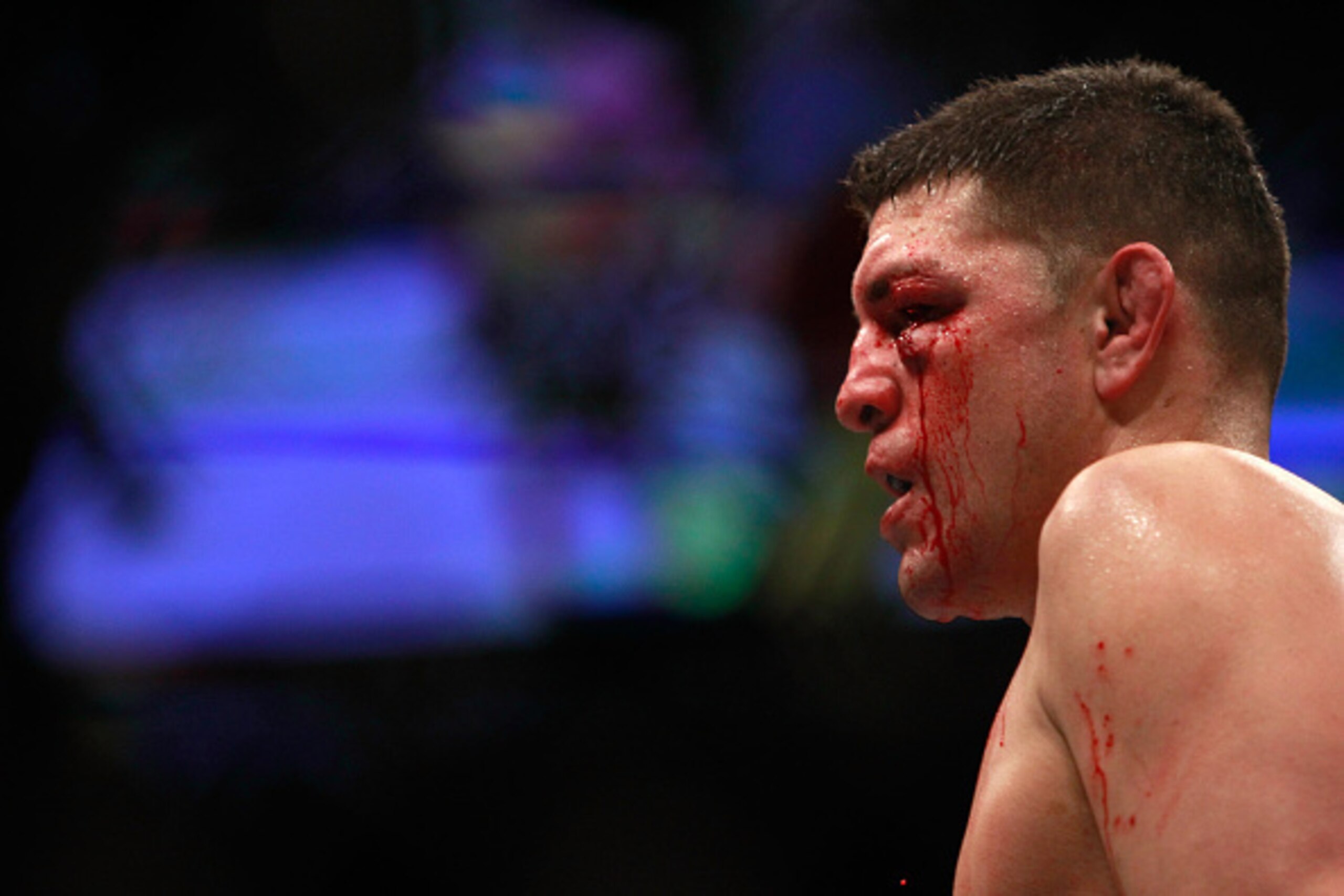 LAS VEGAS, NV - JANUARY 31:  Nick Diaz stands in the Octagon after taking a hit from Anderson Silva in a middleweight bout against Anderson Silva during UFC 183 at the MGM Grand Garden Arena on January 31, 2015 in Las Vegas, Nevada. Silva won by unanimous