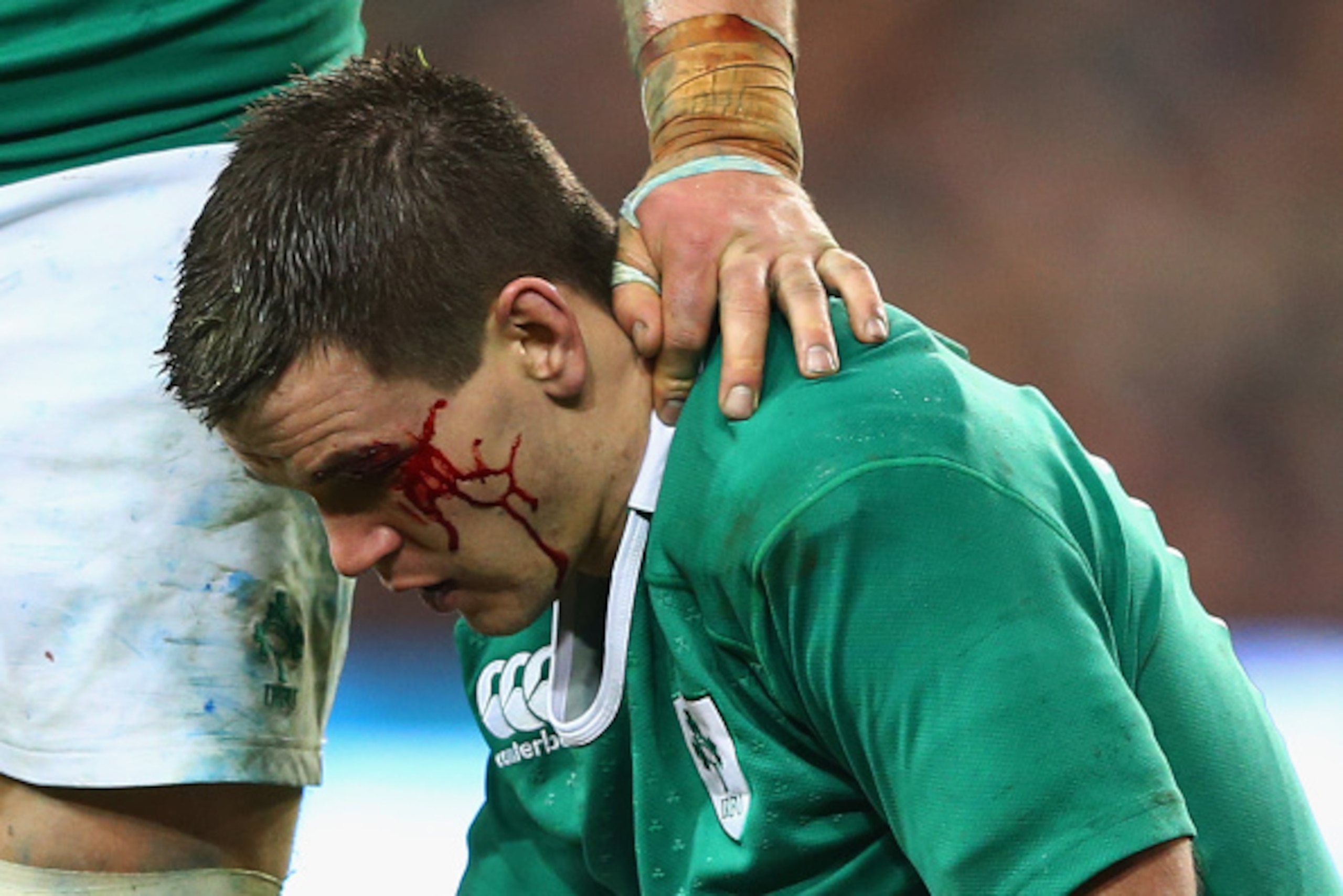 DUBLIN, IRELAND - FEBRUARY 14:  An injured Jonathan Sexton of Ireland suffers a cut to his eye during the RBS Six Nations match between Ireland and France at Aviva Stadium on February 14, 2015 in Dublin, Ireland.  (Photo by Michael Steele/Getty Images)