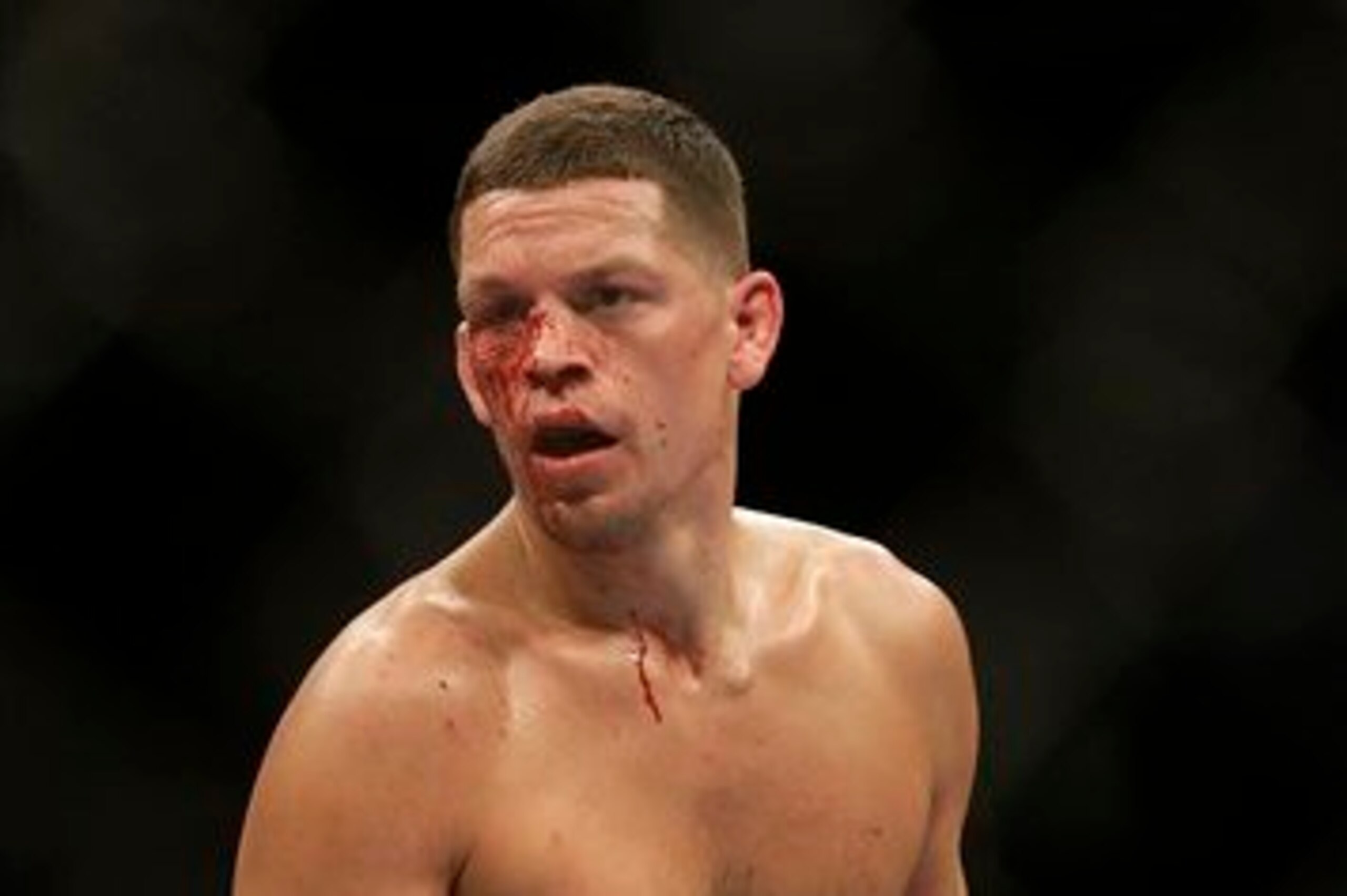 Nate Diaz Nate Diaz