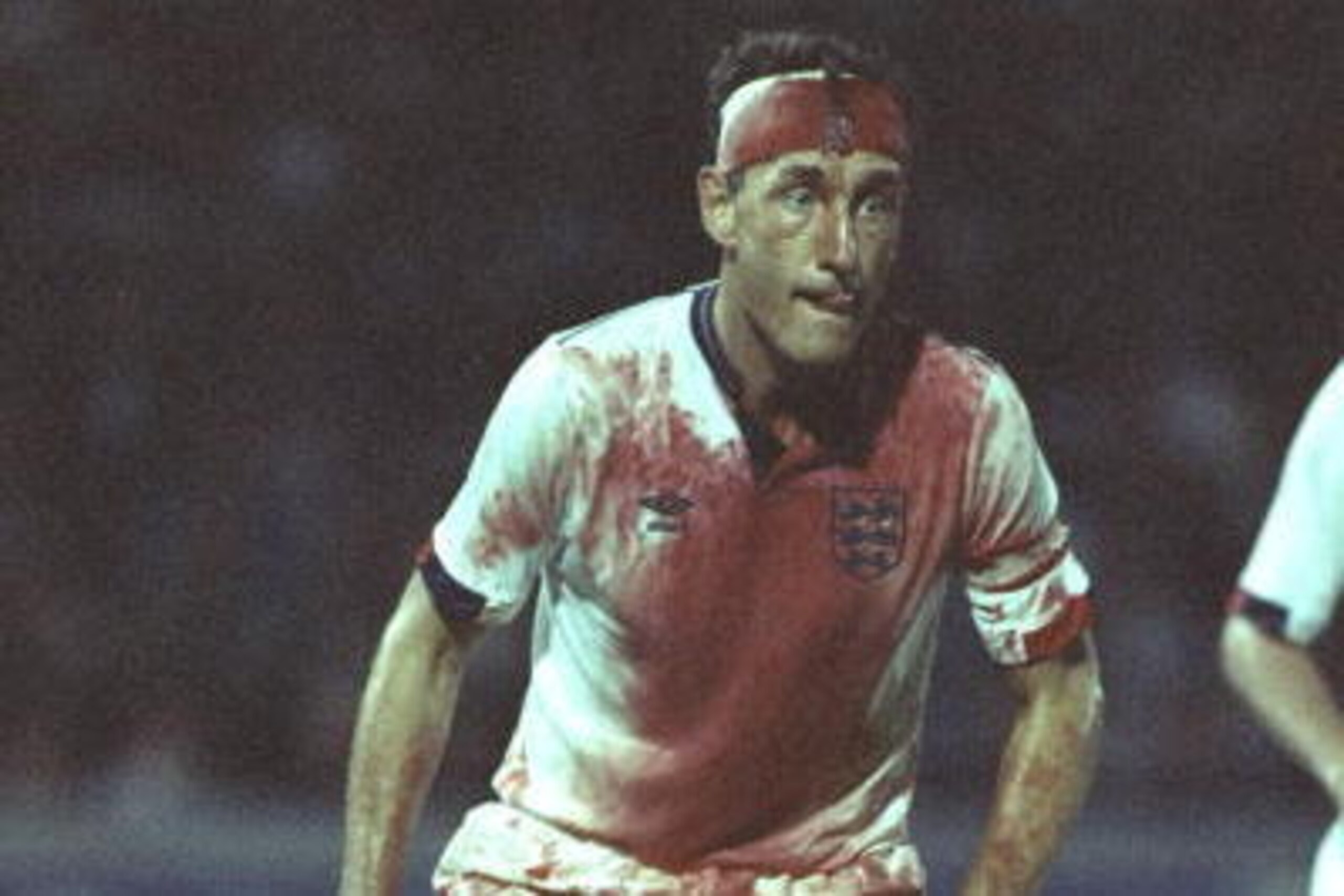 6 Sep 1989:  A bloody Terry Butcher in action during the World Cup Qualifier against Sweden at Stockholm, Sweden. The game was drawn 0-0. \ Mandatory Credit: David Cannon /Allsport
